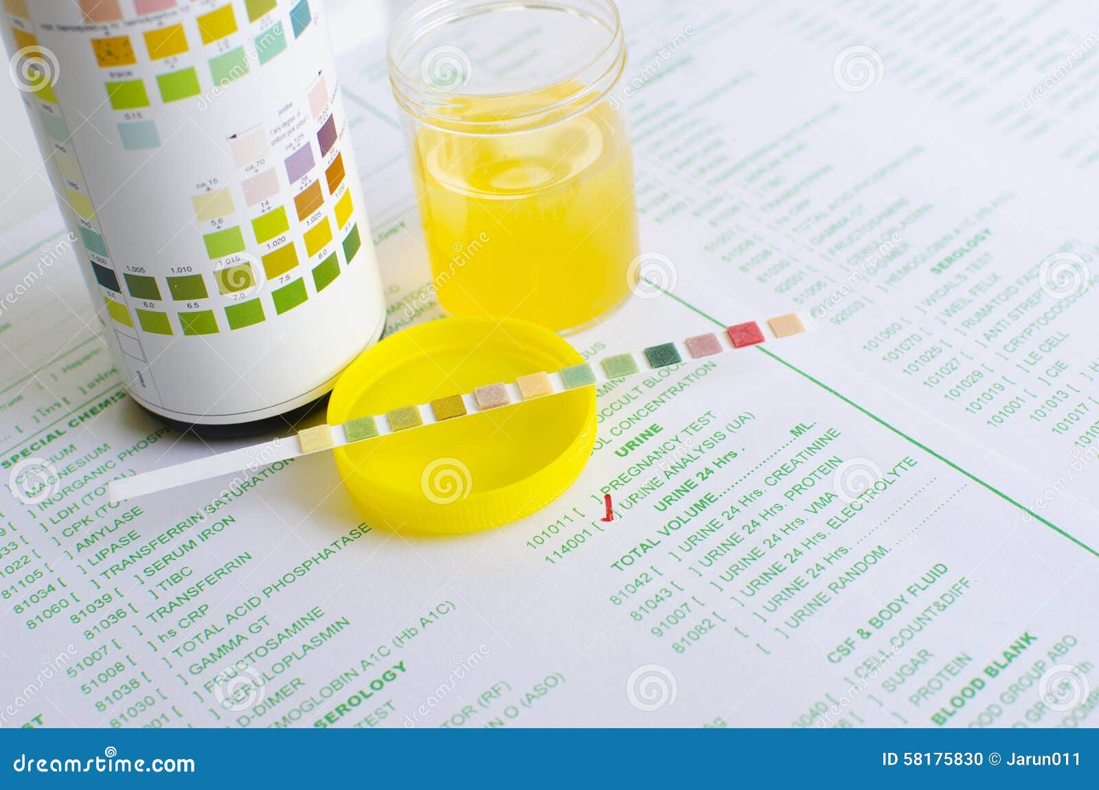 Urine analysis stock photo. Image of biology, urine, test 58175830
