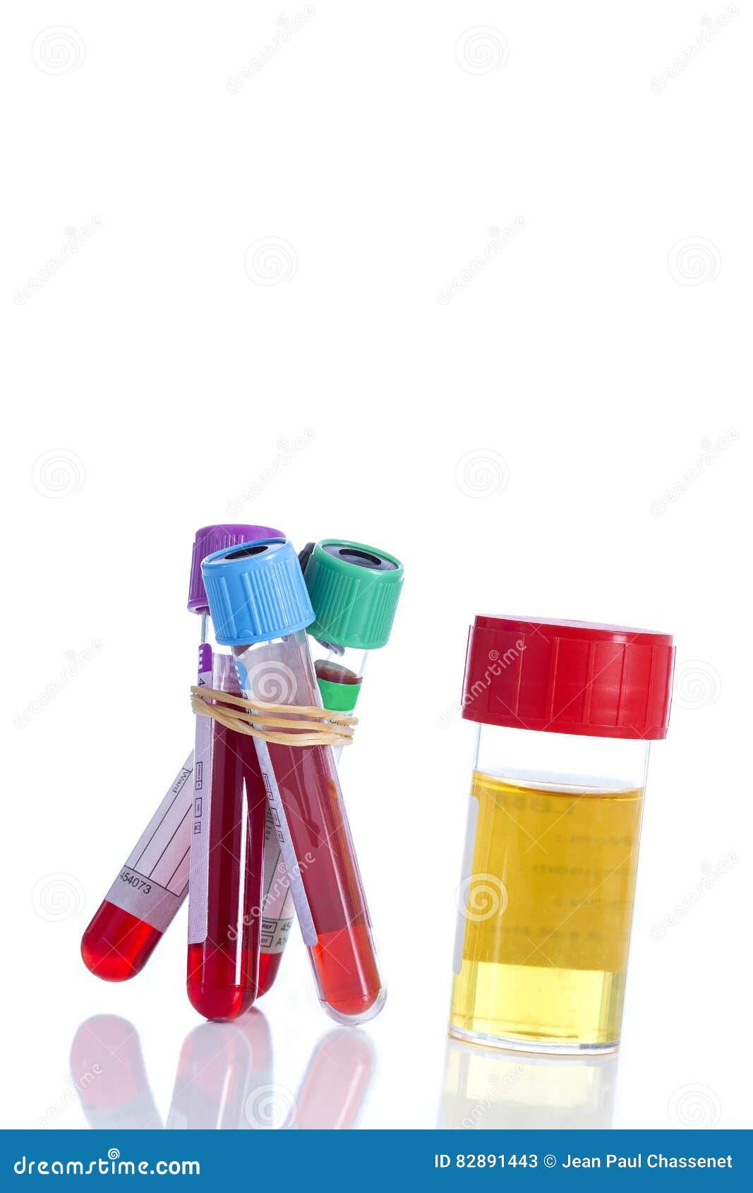 Urine and Blood Sample on a Form for Examination Stock Image Image of