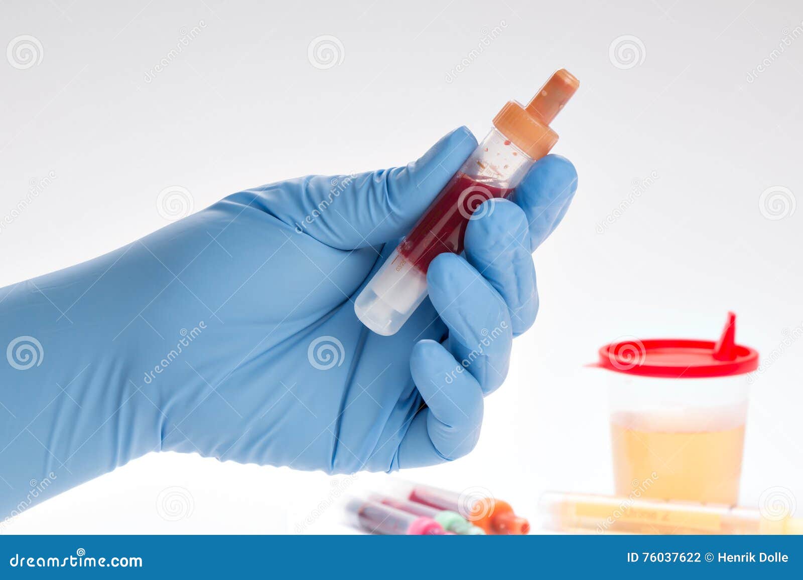 Urine and Blood Test Blood Count) Stock Photo Image of