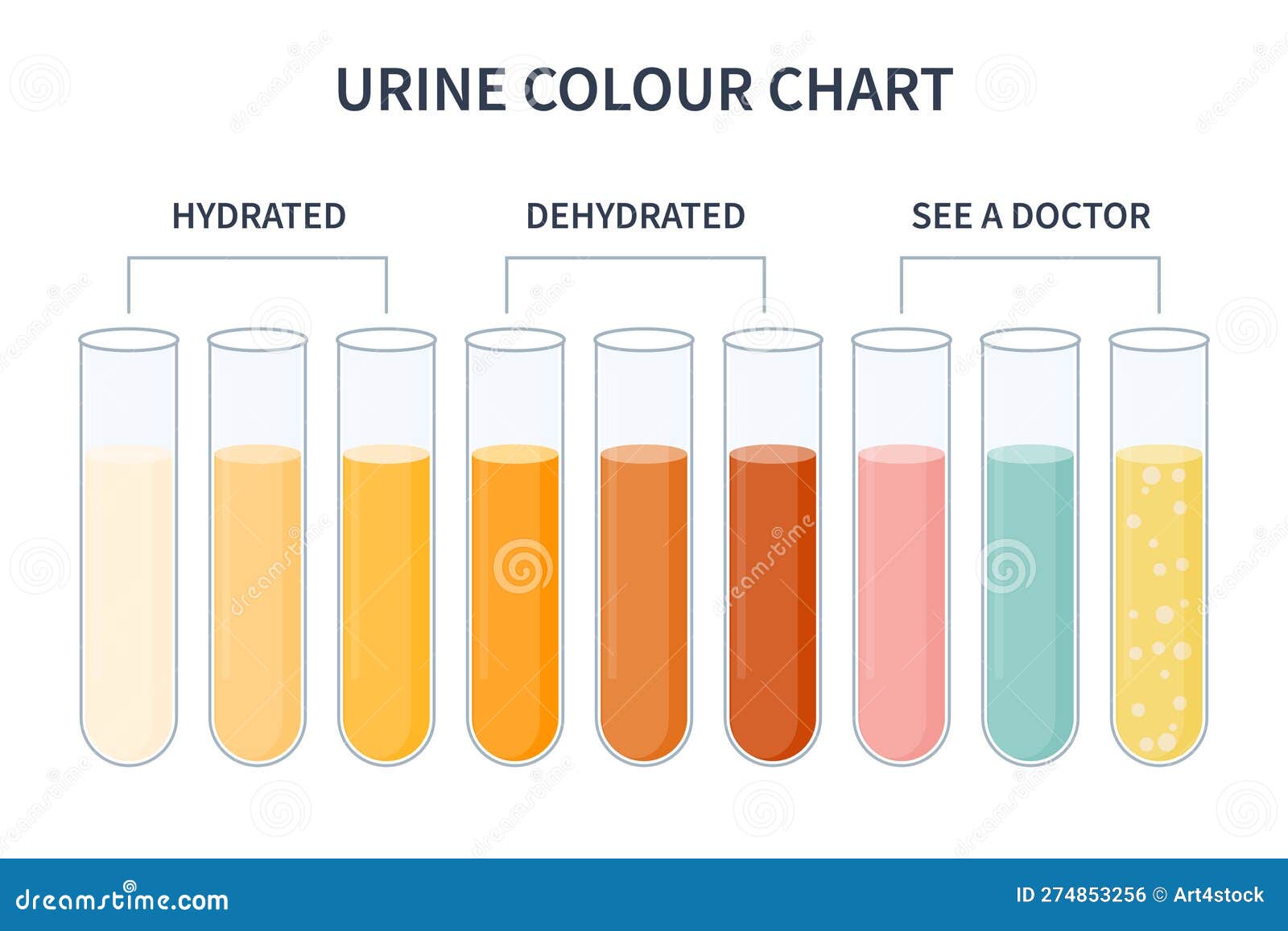 Urine Color Chart Illustration Of Dehydration Level | CartoonDealer.com ...