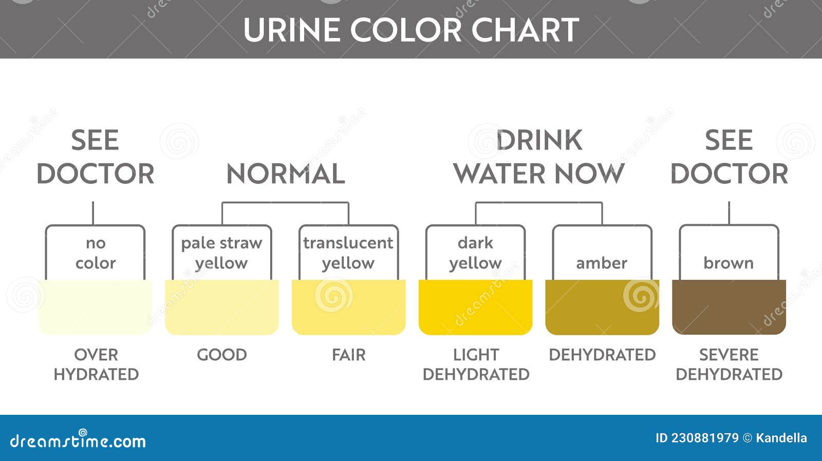 Urine color chart . stock vector. Illustration of disease - 230881979