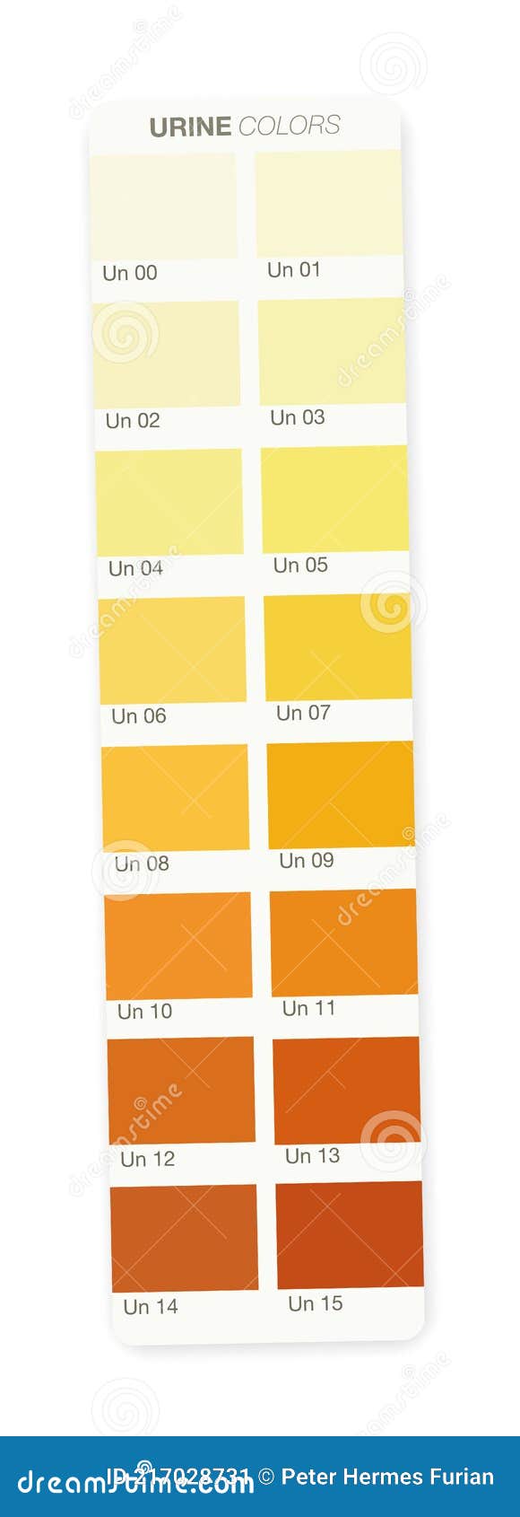 Urine Colors Color Stripe Samples Dehydration Dark Light Urine Stock Vector  - Illustration of medicine, colored: 217028731