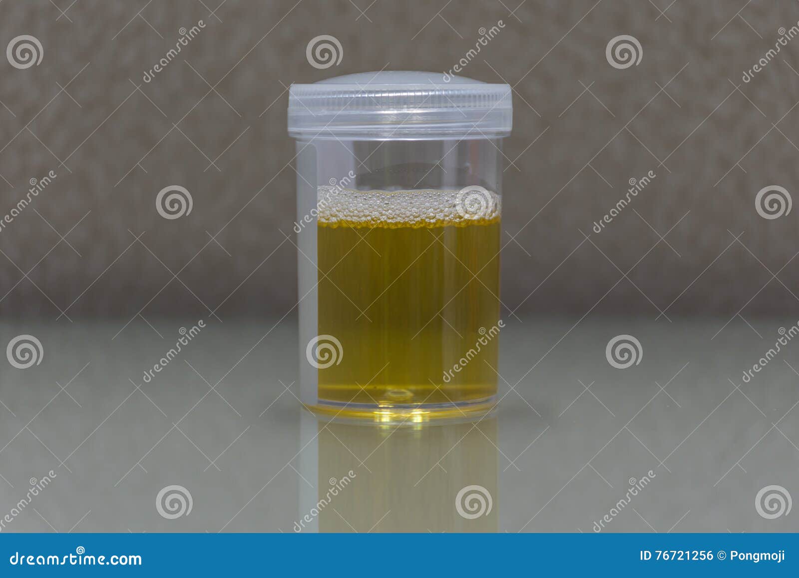 Urine for Examination in Laboratory Stock Photo Image of health, care