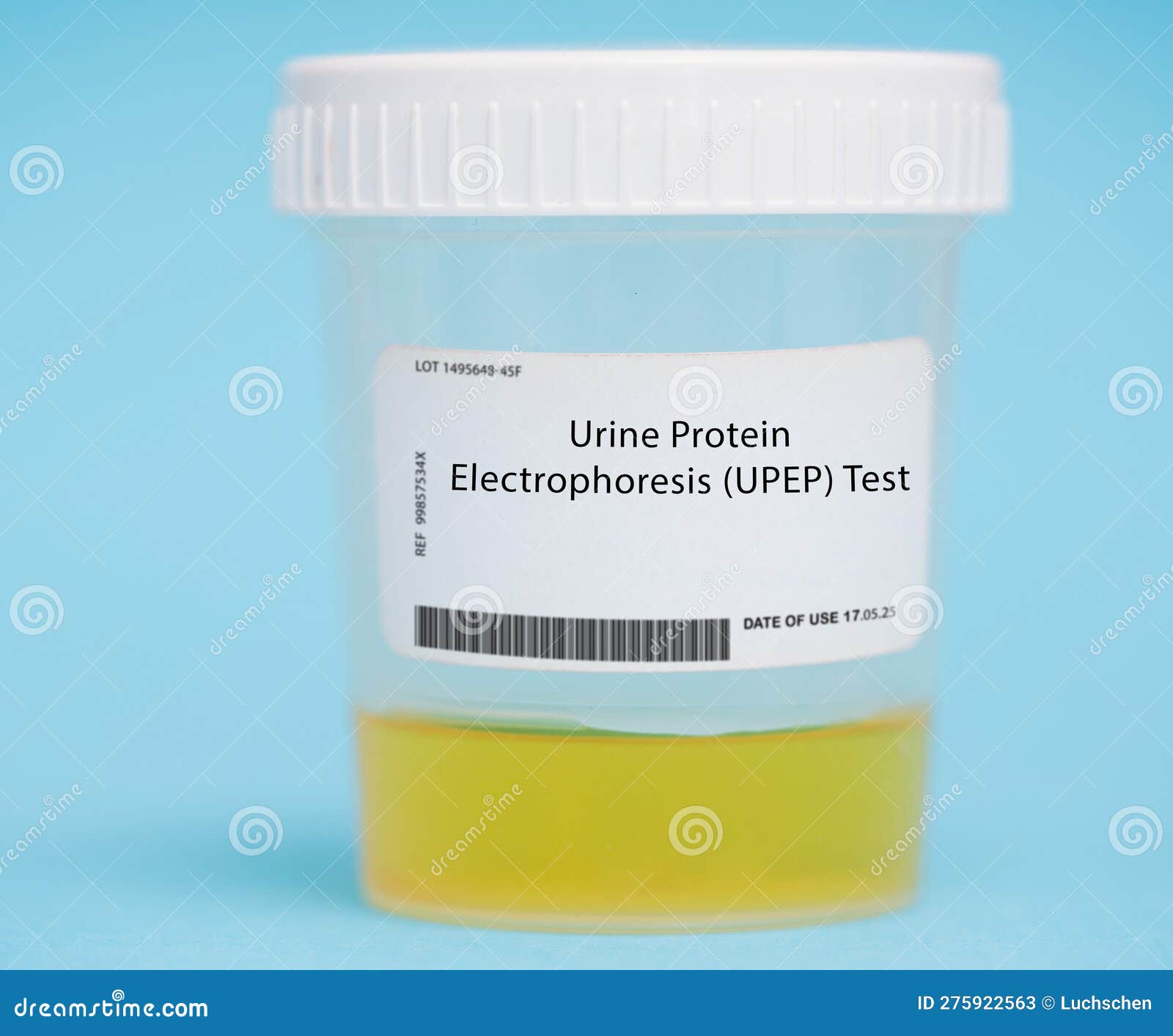 Urine Protein Electrophoresis (UPEP) Test Stock Image Image of used