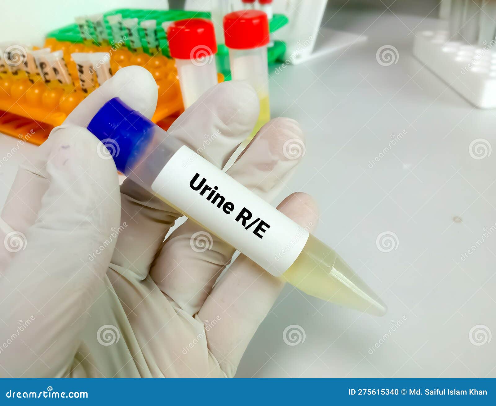 Urine routine examination stock photo. Image of medical 275615340