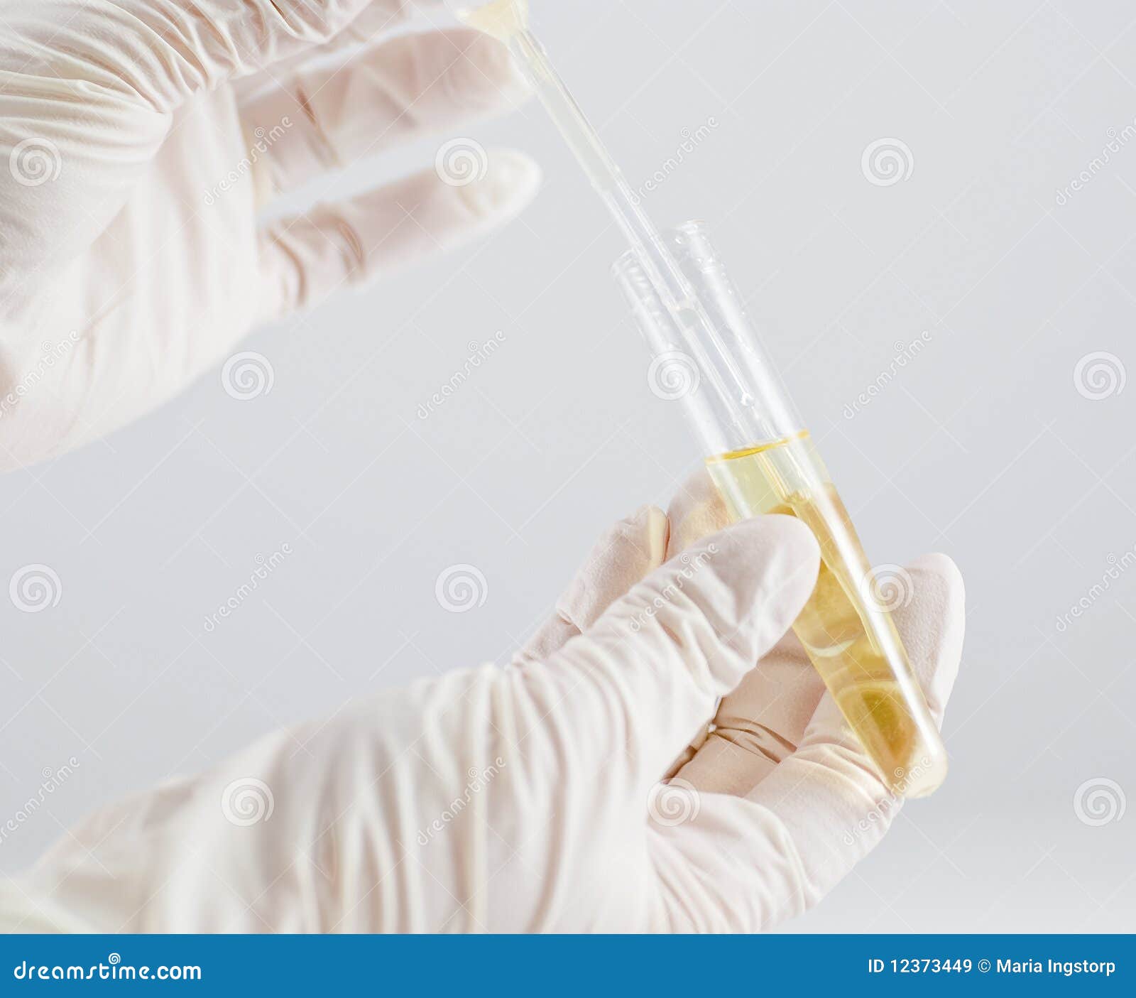 urine sample