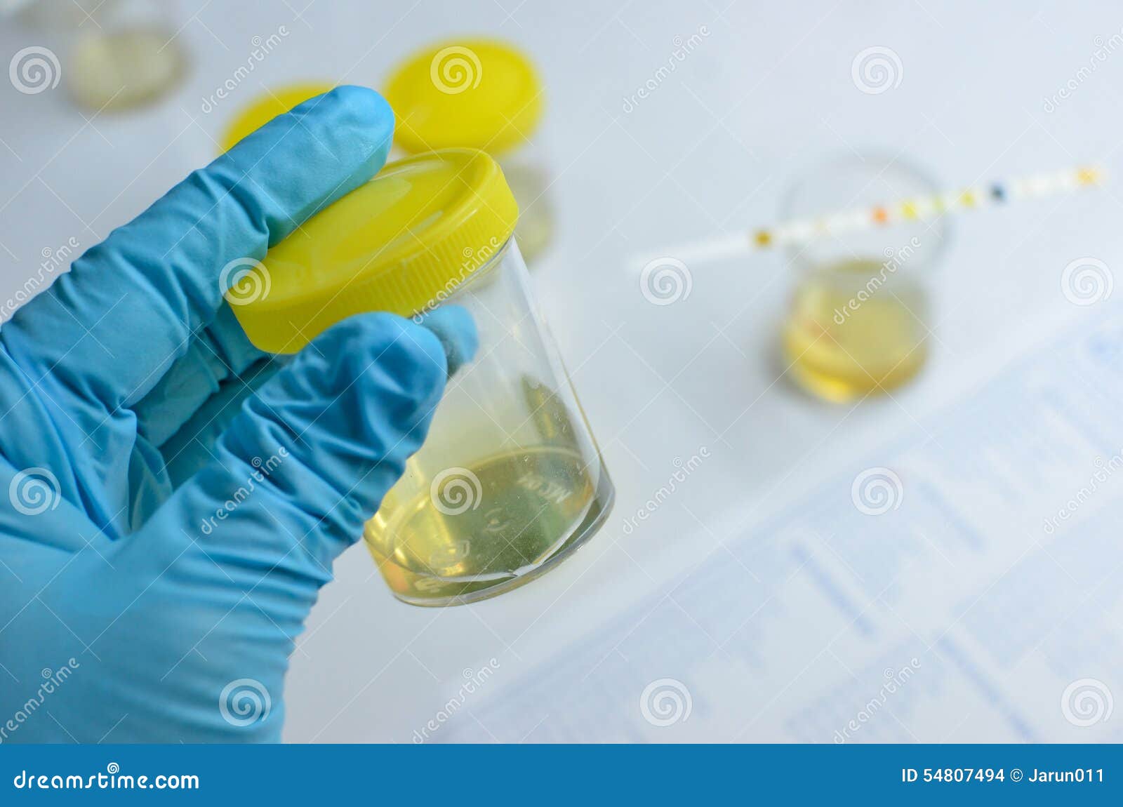 urine sample