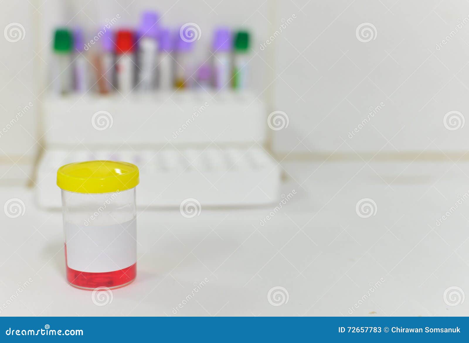 Urine sample bottle stock image. Image of experiment 72657783