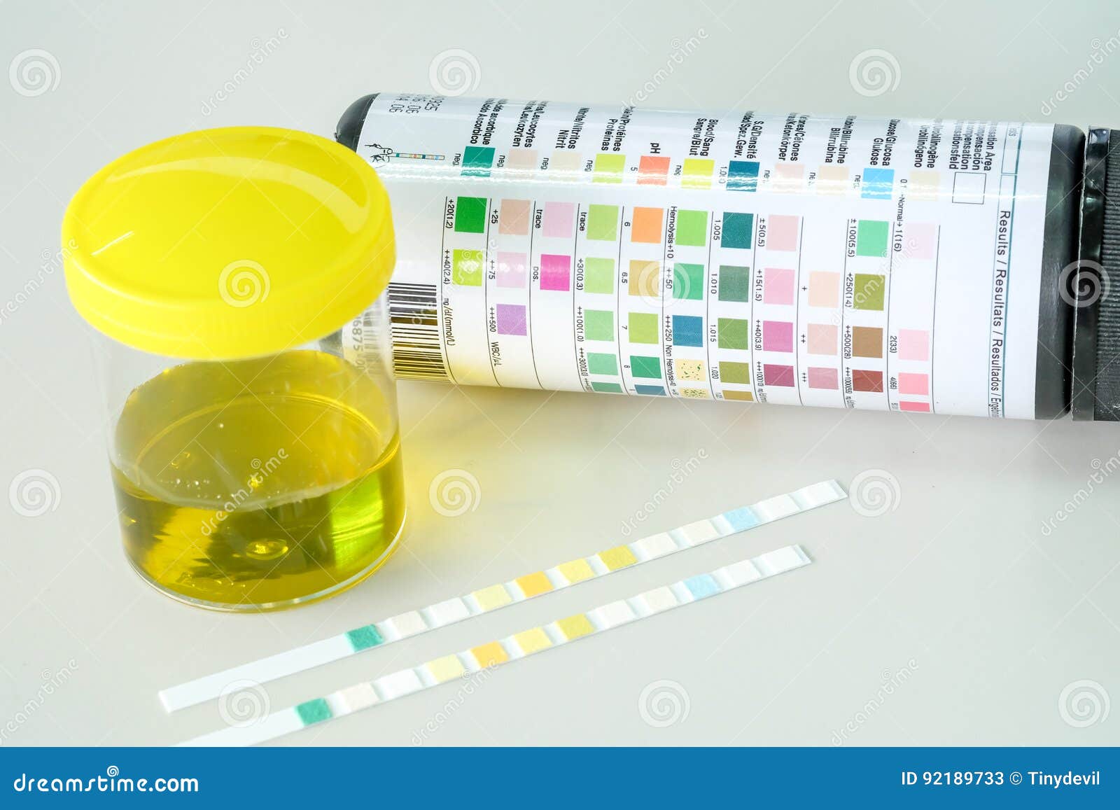 Urine strip test stock image. Image of specimen, analysis 92189733
