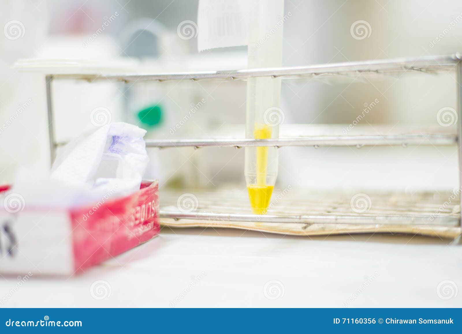 Urine yellow in tube. stock photo. Image of bacteria 71160356