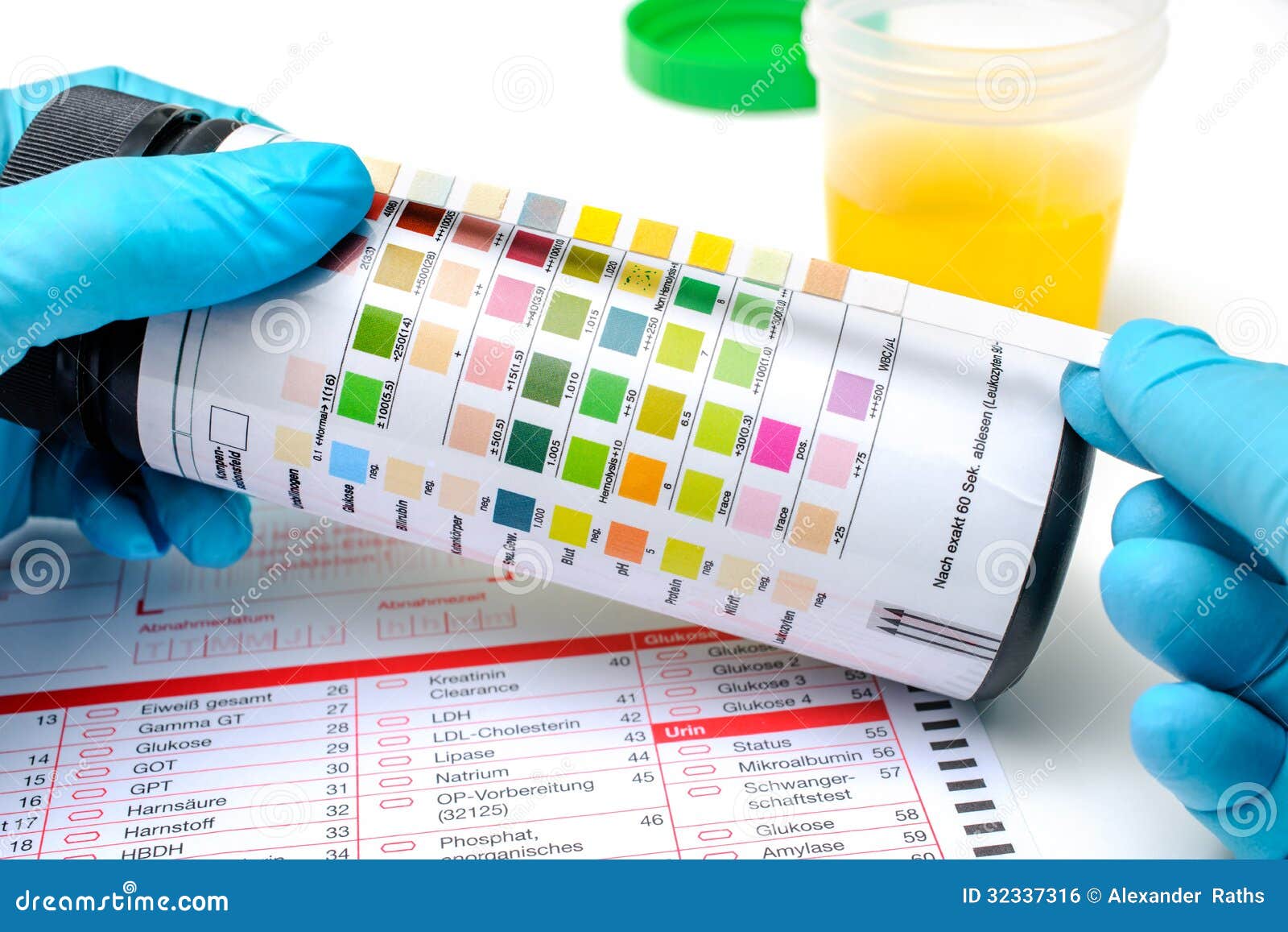 URINTESTSTREIFEN ABLESEN DAS M SSEN SIE WISSEN visual data 8