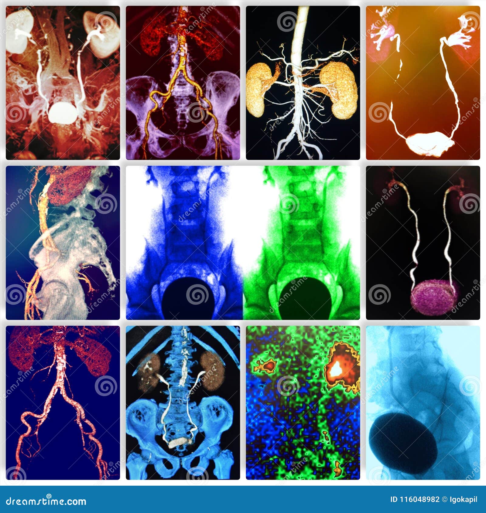 My Image 25