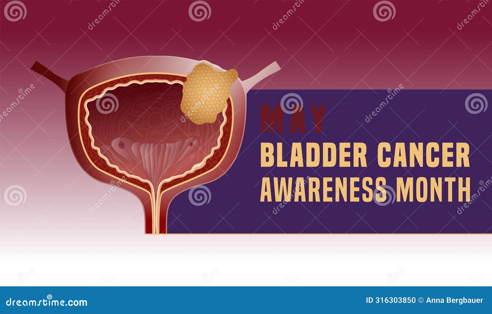 urothelial carcinoma landscape poster. urinary bladder cancer banner