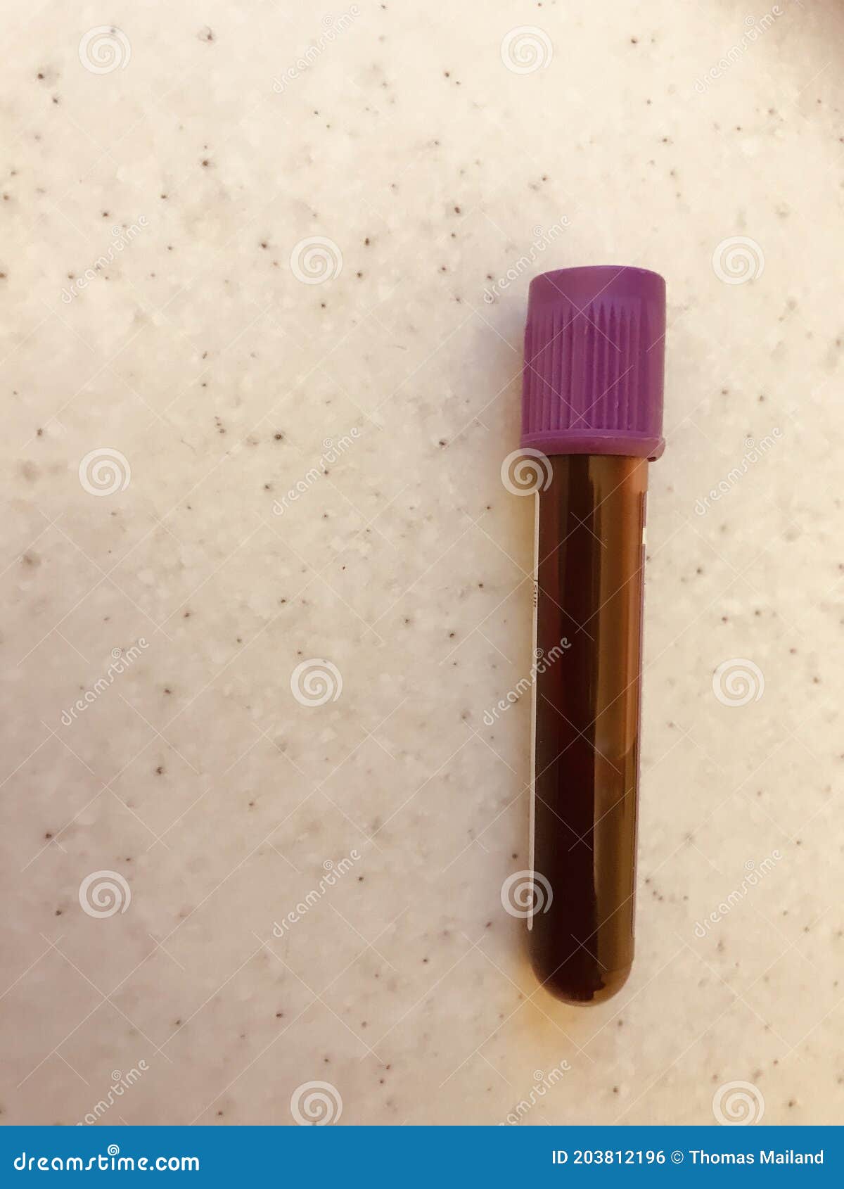 Lavender Top Blood Sample Edta Vacuum Tube Full Of Blood Stock Photo Image Of Form Laboratory