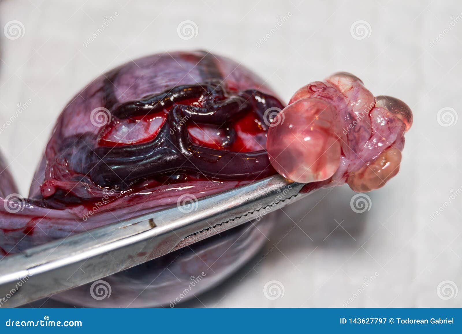 Utero Di Un Gatto Con Piometra E Una Grande Ciste Ovarica Immagine Stock Immagine Di Ovarian Gatto Utero Di Un Gatto Con Piometra E Una Grande Ciste Ovarica Immagine Stock Immagine Di Ovarian Gatto