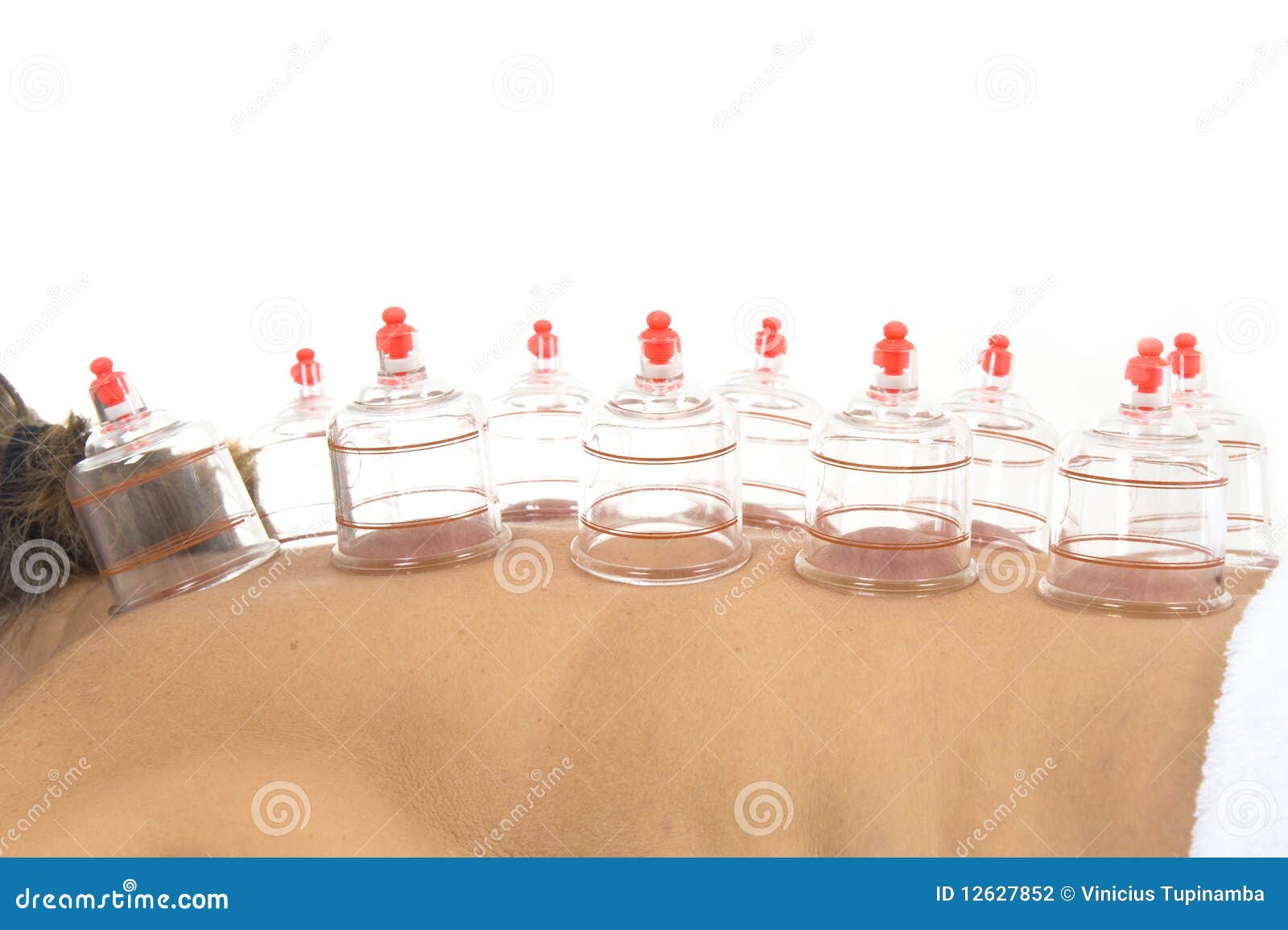Vacuum treatment stock photo. Image of care, wellness 12627852