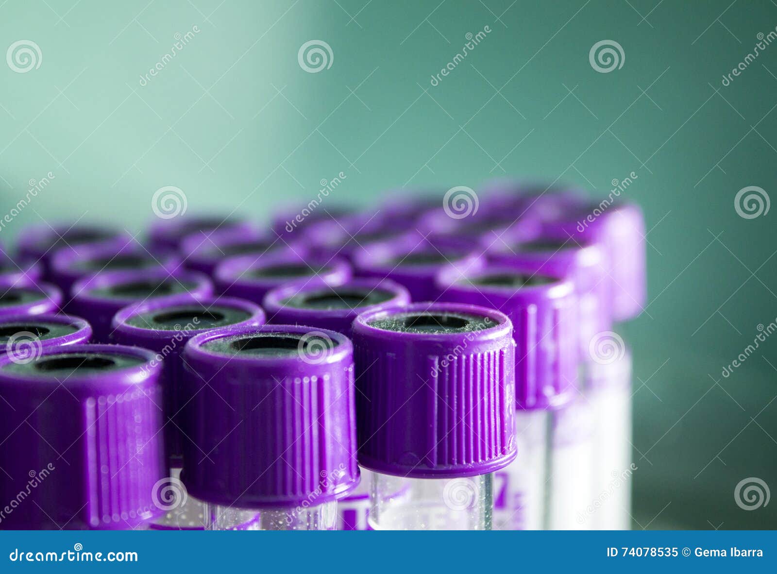 Vacuum Tubes for Blood Analysis Stock Image Image of sample, medicine