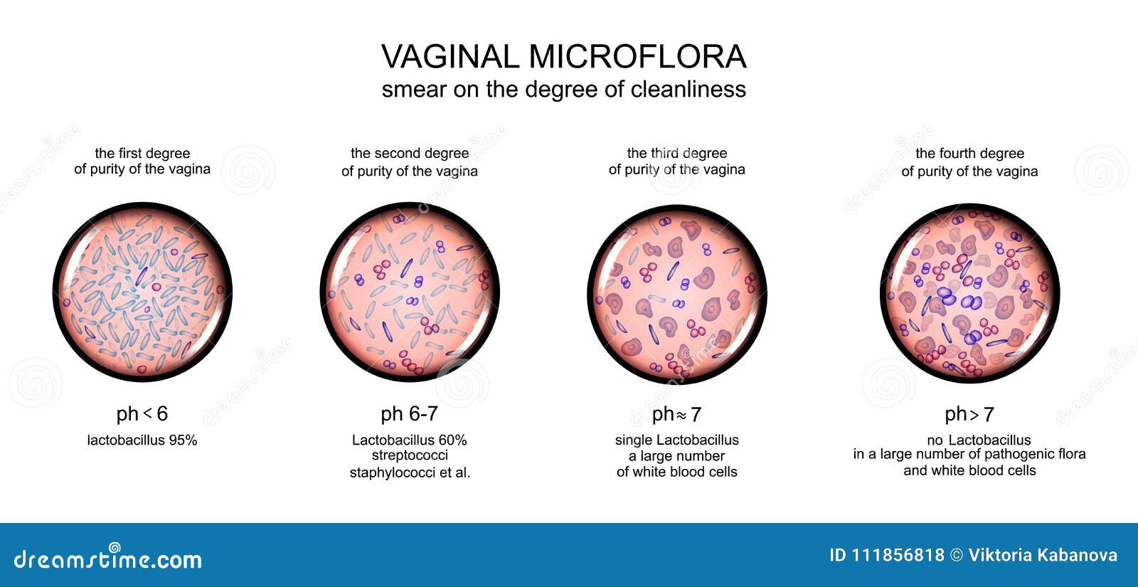 vaginal microflora. degree of purity of the vagina