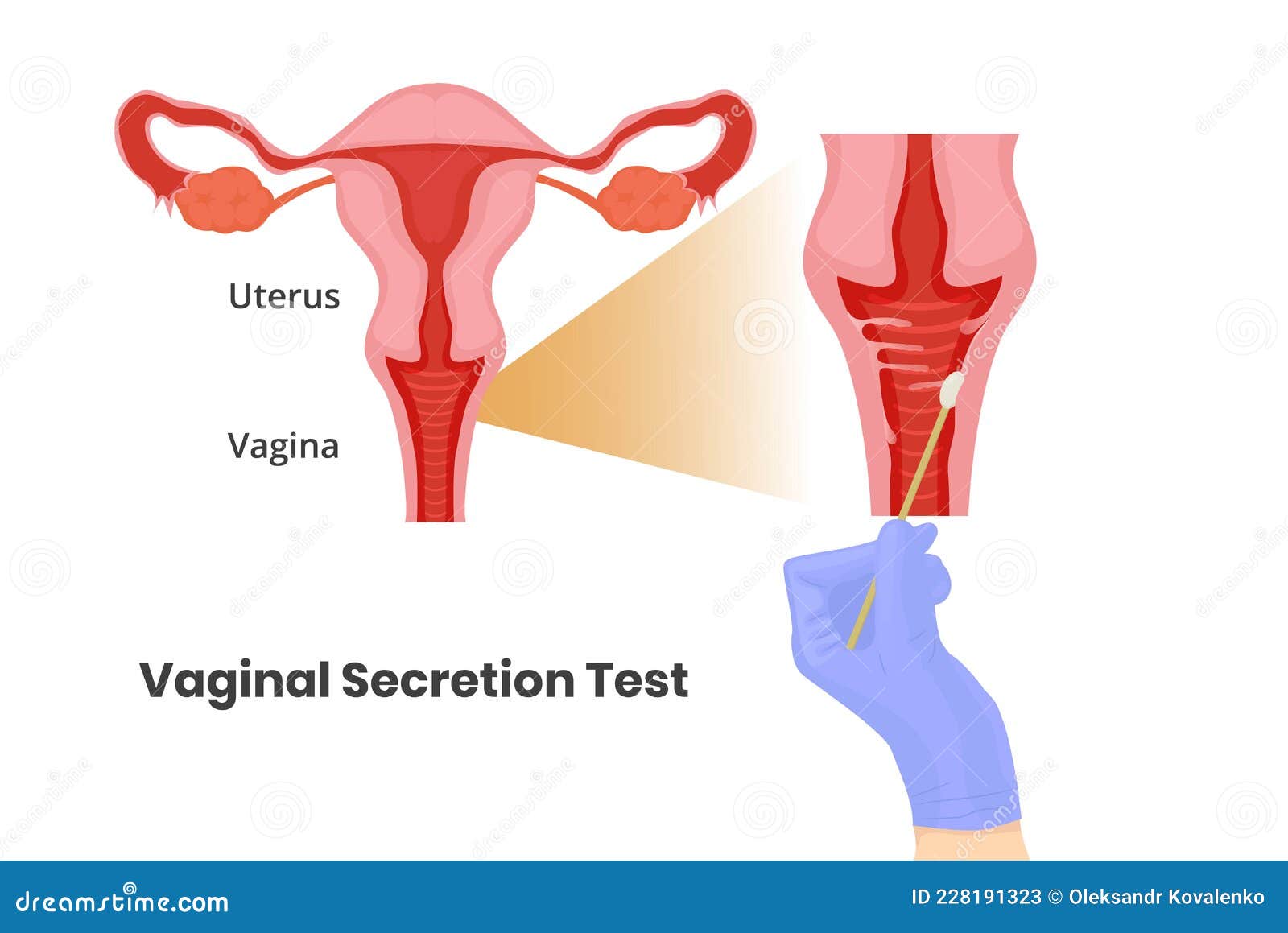 vaginal secretion test. vaginal swab vecor 