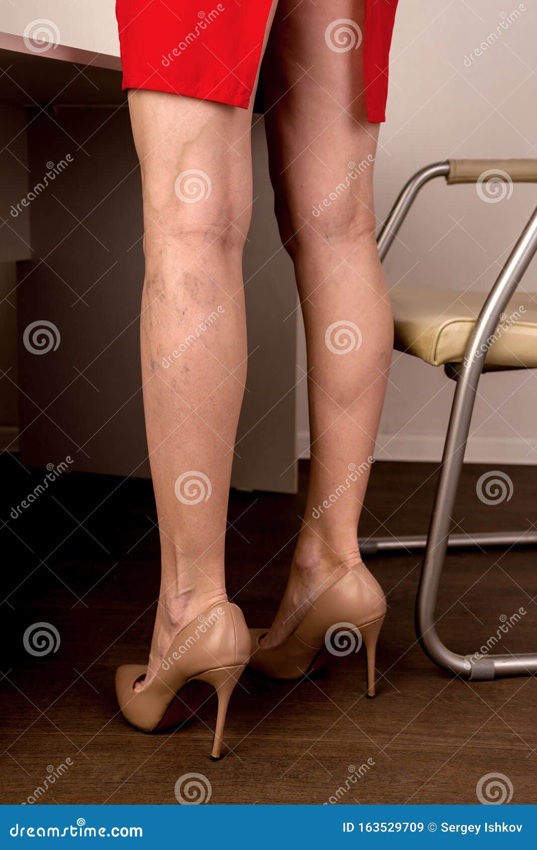 Varicose girl. gorgeous legs - Traducere în română - exemple în engleză | Reverso Context