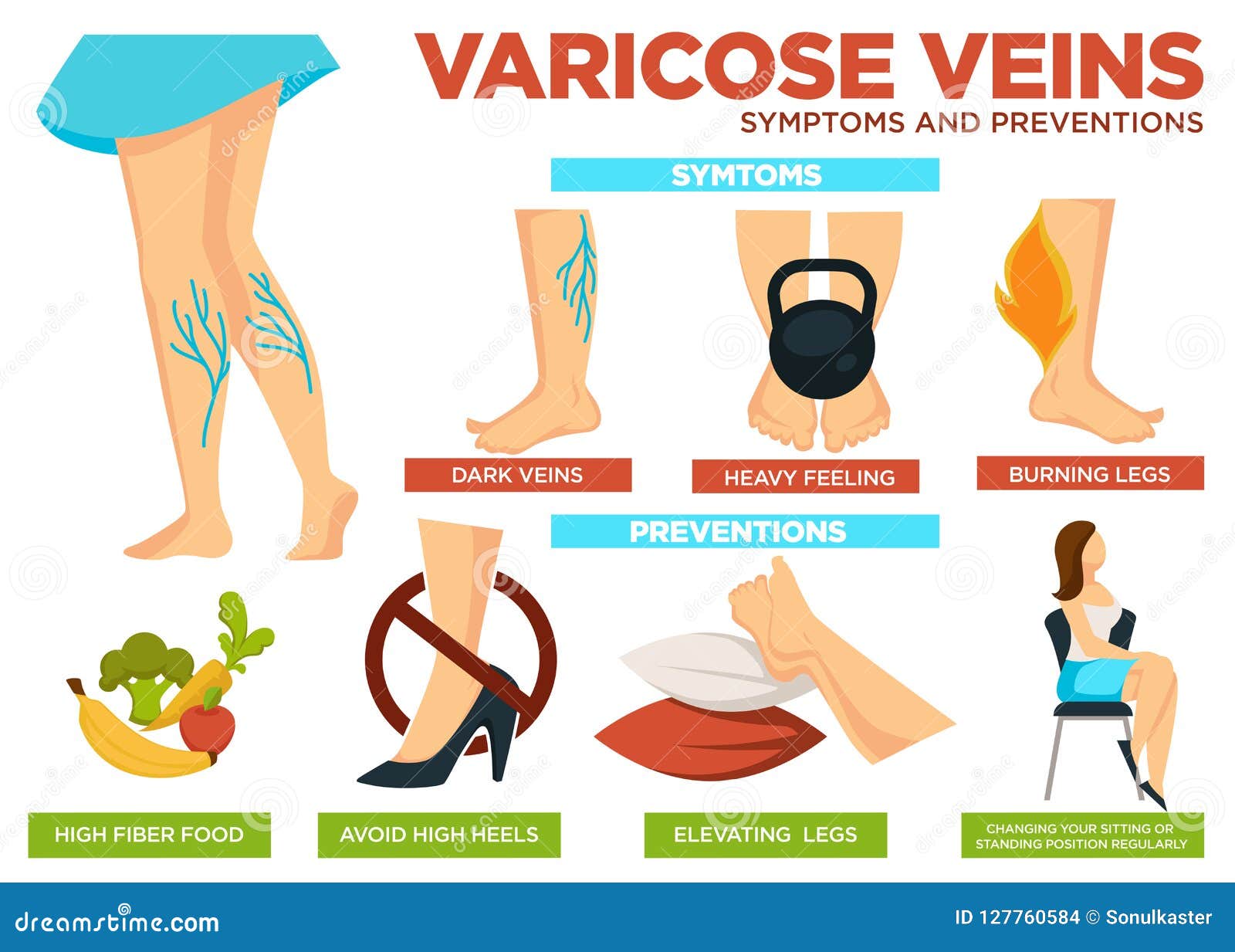 varicose veins symptoms)