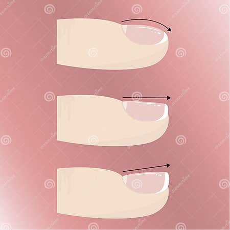 Varieties of Different Forms and Types of Nail Plate. Manicure and Nail ...