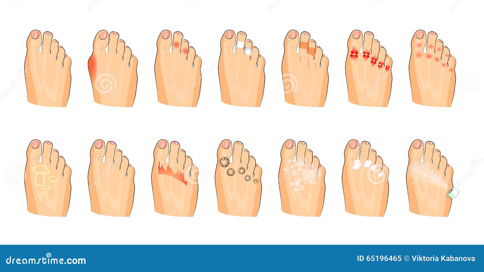 Various foot damage stock vector. Illustration of adhesive 65196465