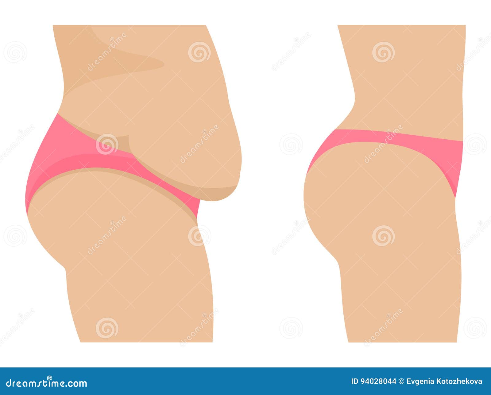 female abdomen before after losing weight