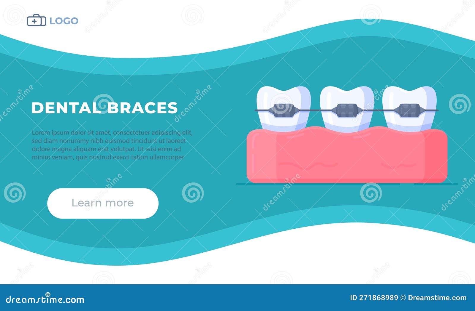 Vector Illustration of Dental Braces. the Concept of Dental Braces Stock Vector Illustration