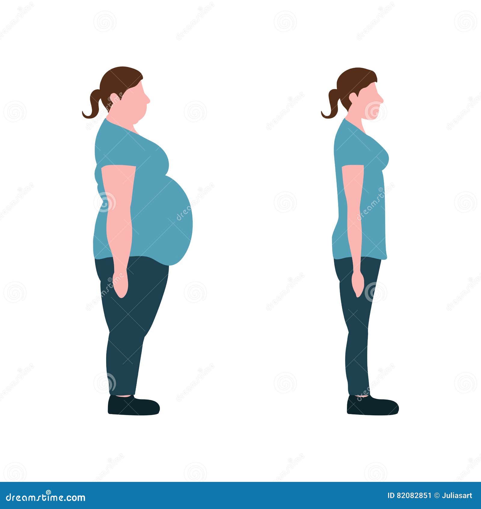 Vector Illustration. Figures of Women Thick and Thin. Stock Vector ...