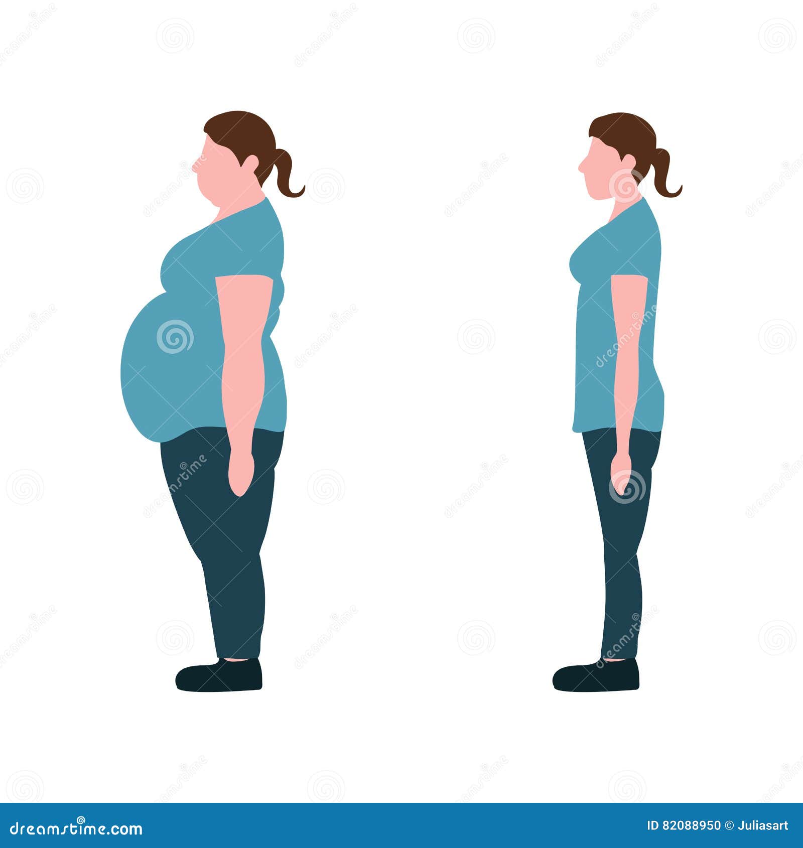 Vector Illustration. Figures of Women Thick and Thin. Stock Vector ...