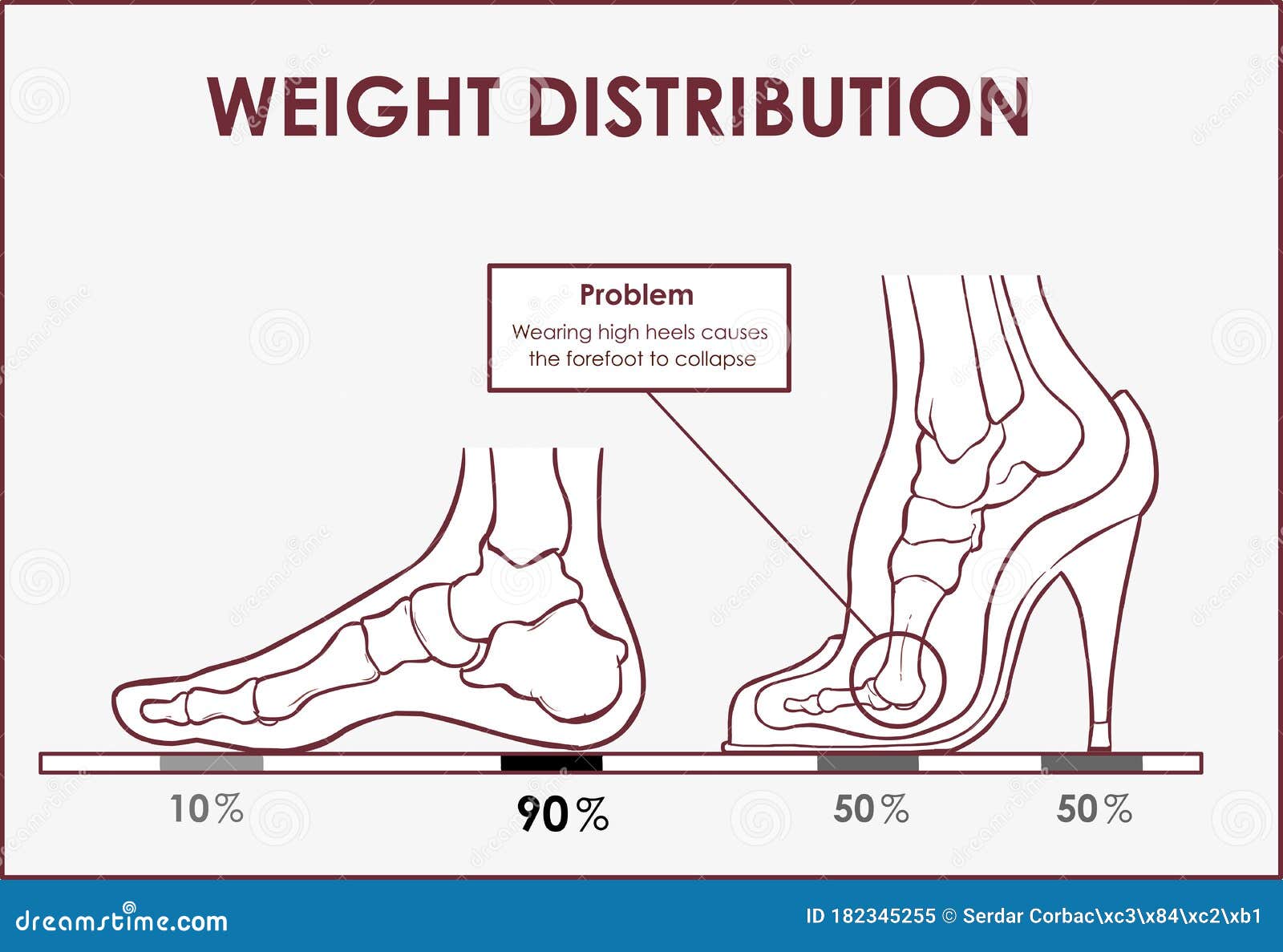 Foot Pain Causes From Zones Diagnosis And Painful Spots Areas Outline