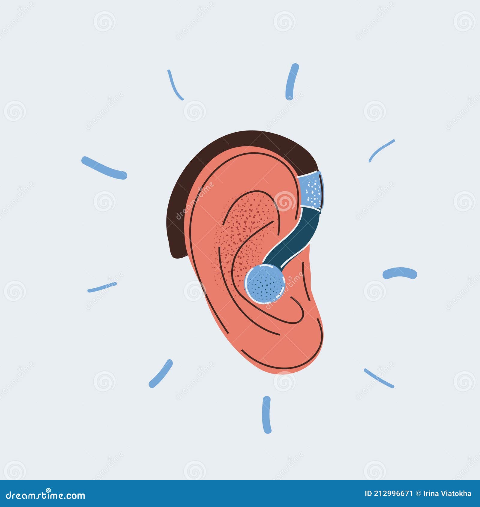 Vector Illustration of Hearing Aid in Human Ear on White Backround