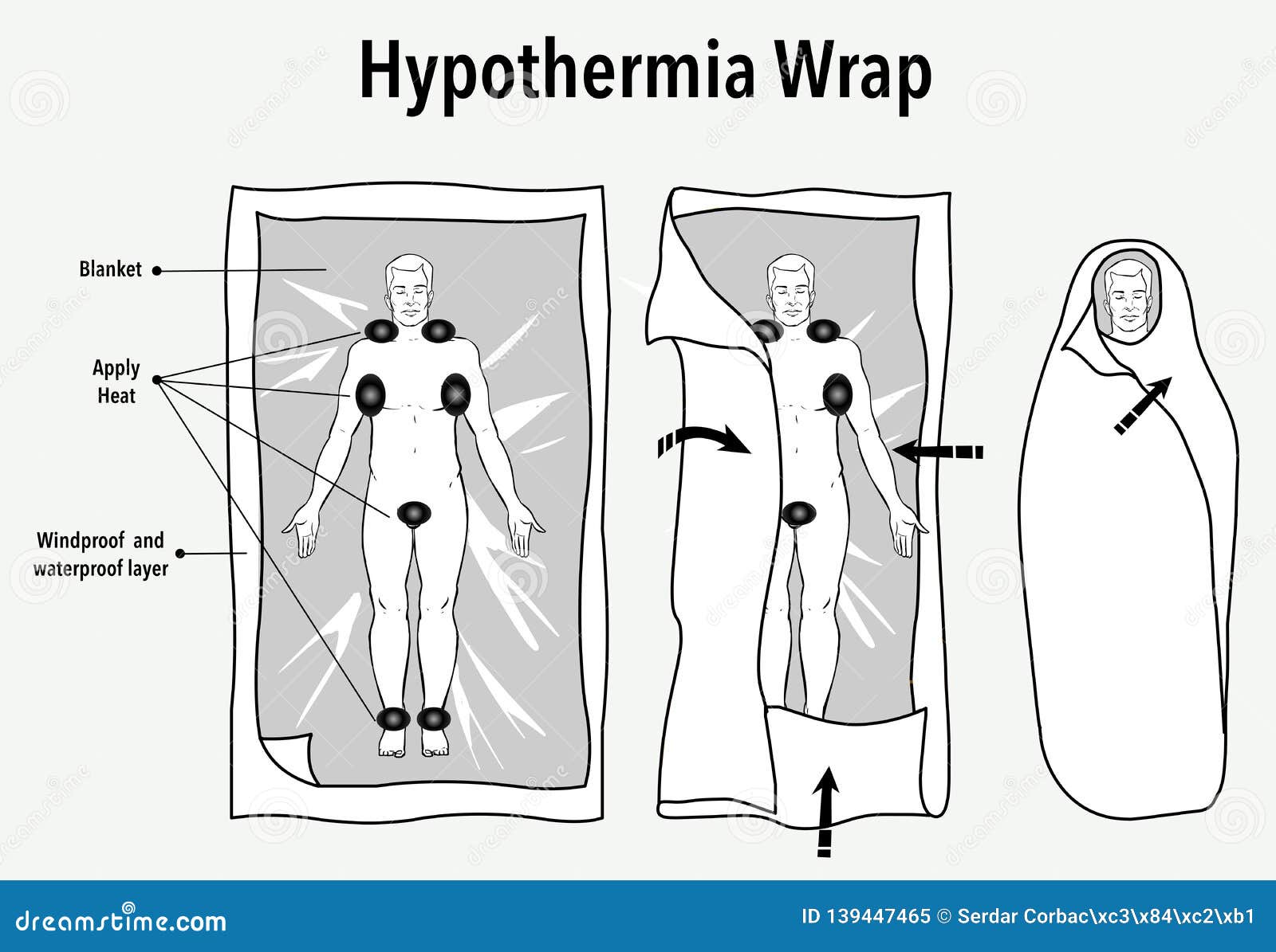 Vector Illustration of a Hypothermia Wrap and First Aid Stock Vector