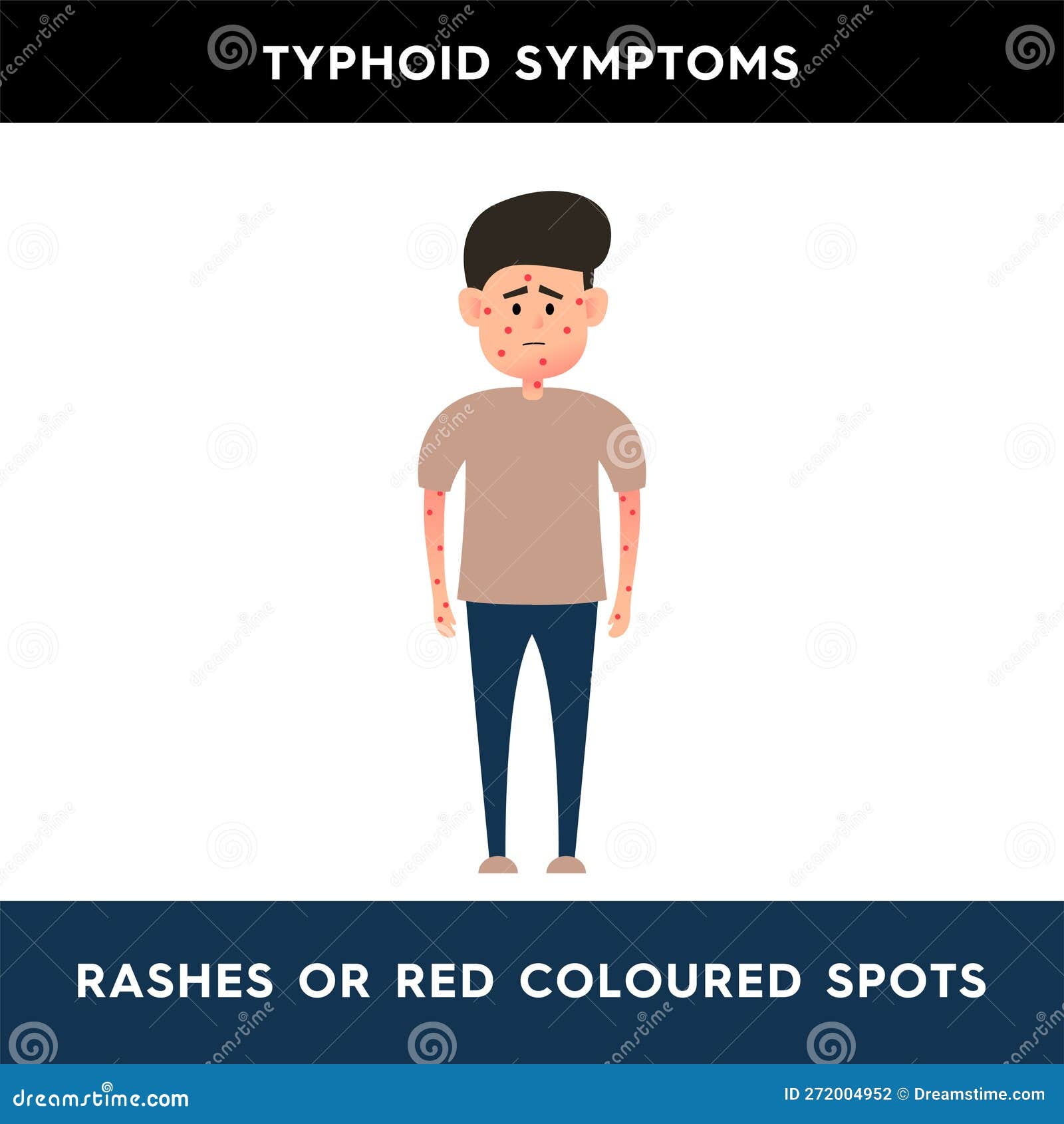Typhoid Fever Symptoms typhoid-fever-symptoms