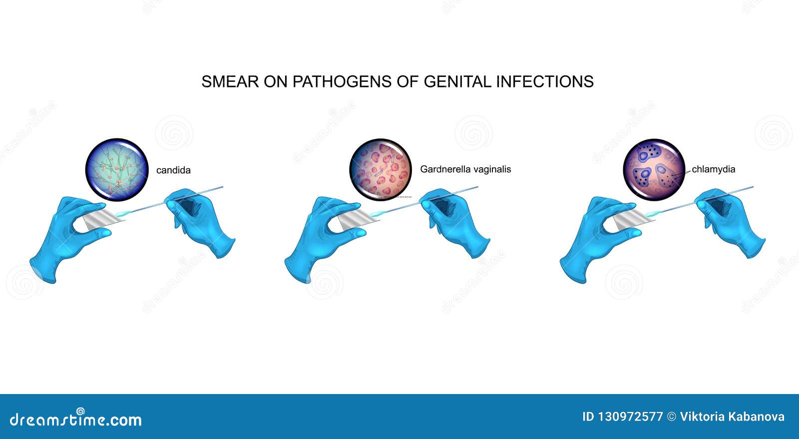 Chlamydia Cartoons, Illustrations & Vector Stock Images - 228 Pictures