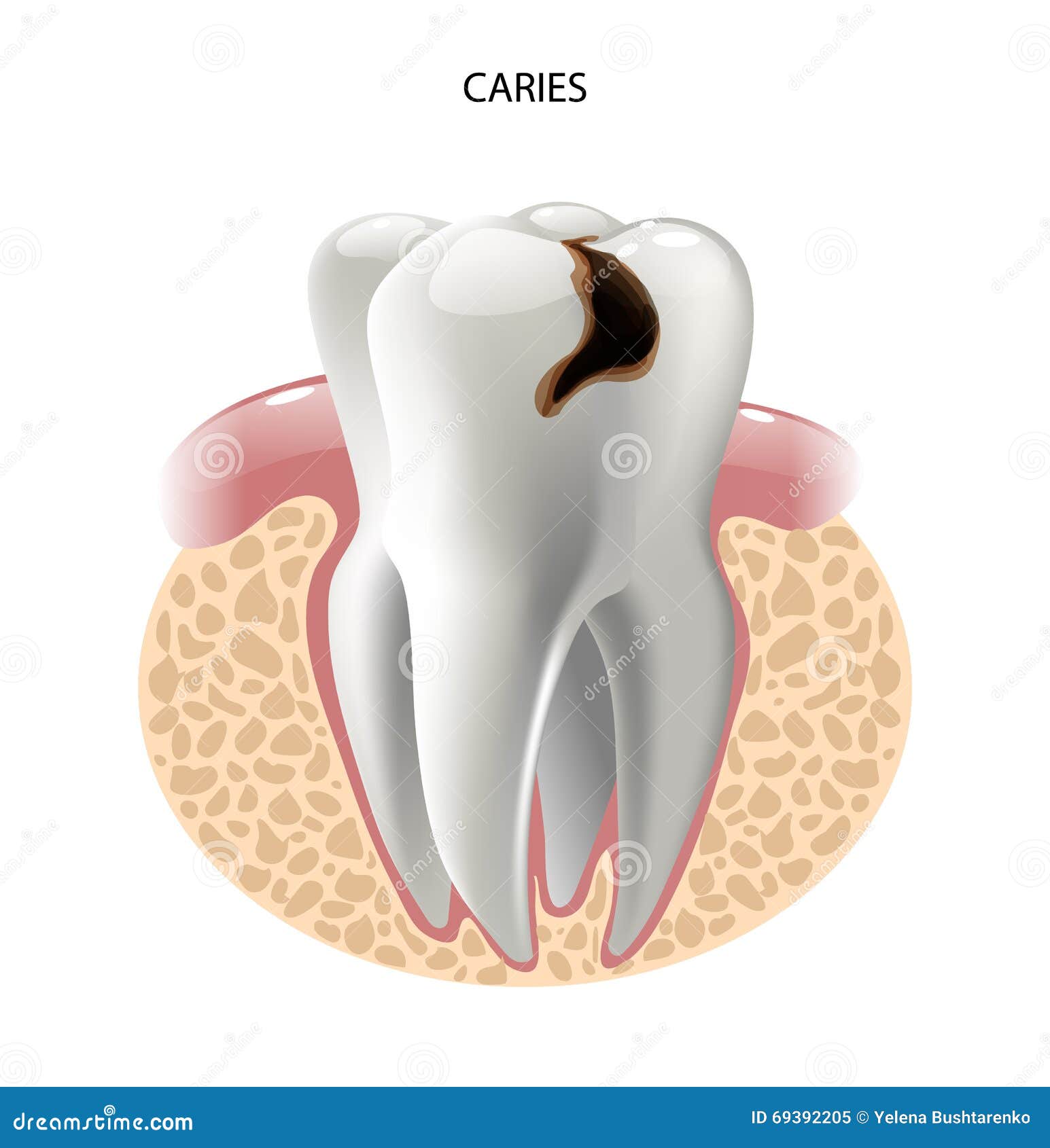 Skull Dental Diagram
