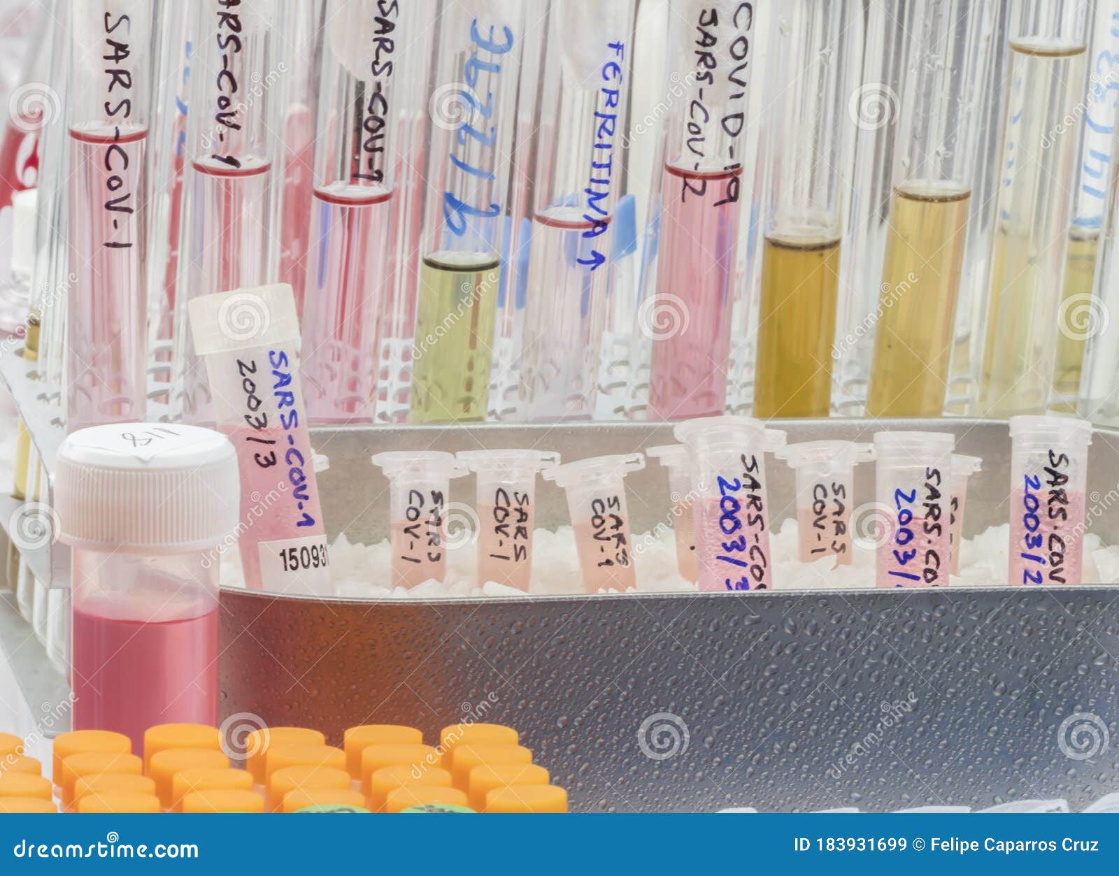 vials with samples of sars-cov-1 prepared cold in a laboratory, epiedomological study on sars-cov-2 covid-19