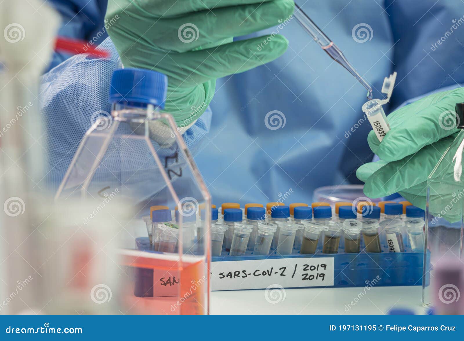 vials with samples of sars-cov-1 prepared cold in a laboratory, epiedomological study on sars-cov-2 covid-19