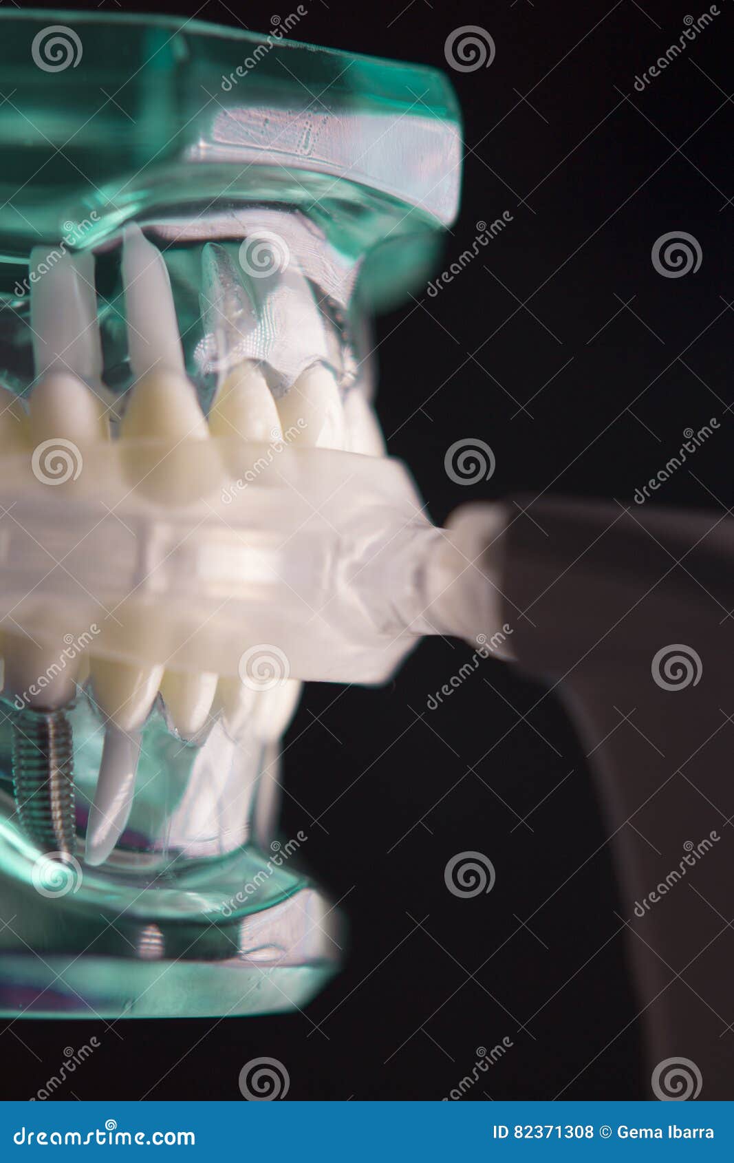 Vibrating Dental Device with Invisible Orthodontics Stock Photo Image