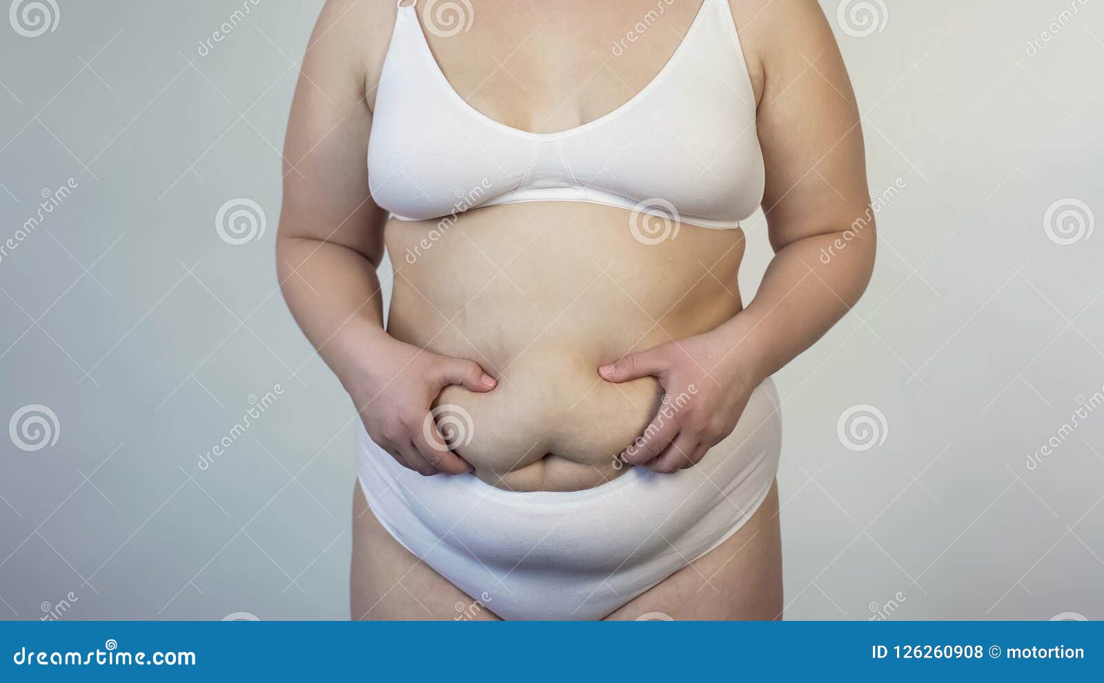 Vientre Caído Conmovedor De La Mujer Obesa, Problema Gordo De Las