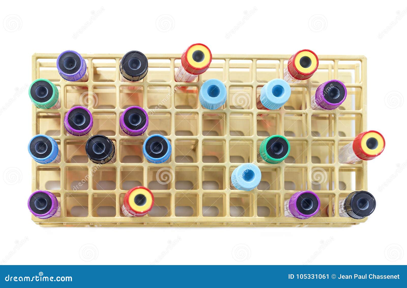 Rack Of Blood Tubes Labeled In Blood Bank Lab RoyaltyFree Stock Image
