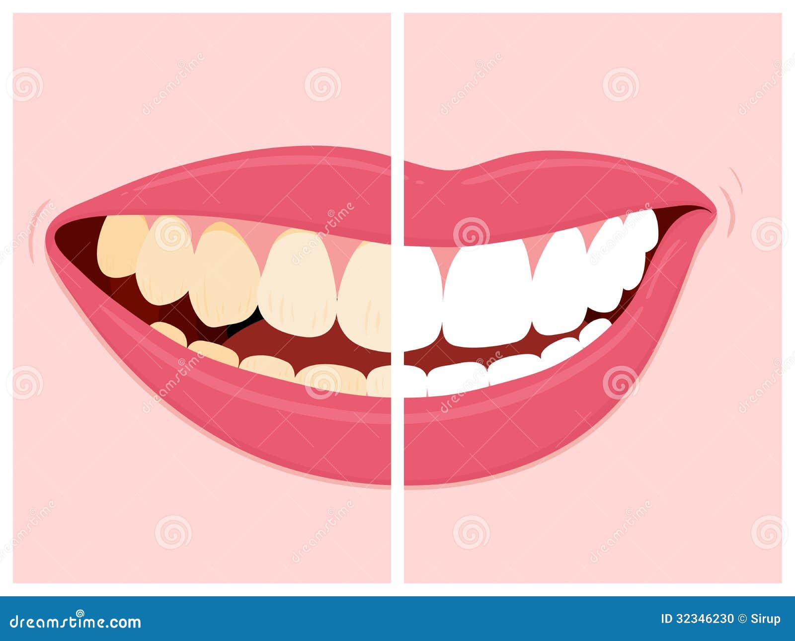 Dental Bleaching Stock Illustrations – 417 Dental Bleaching Stock  Illustrations, Vectors & Clipart - Dreamstime