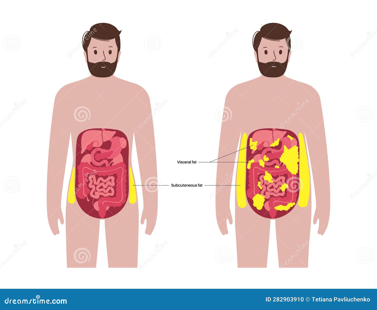 Visceral Fat Diagram Vector Illustration CartoonDealer 281348440 visceral-fat-diagram-vector-illustration-cartoondealer-281348440