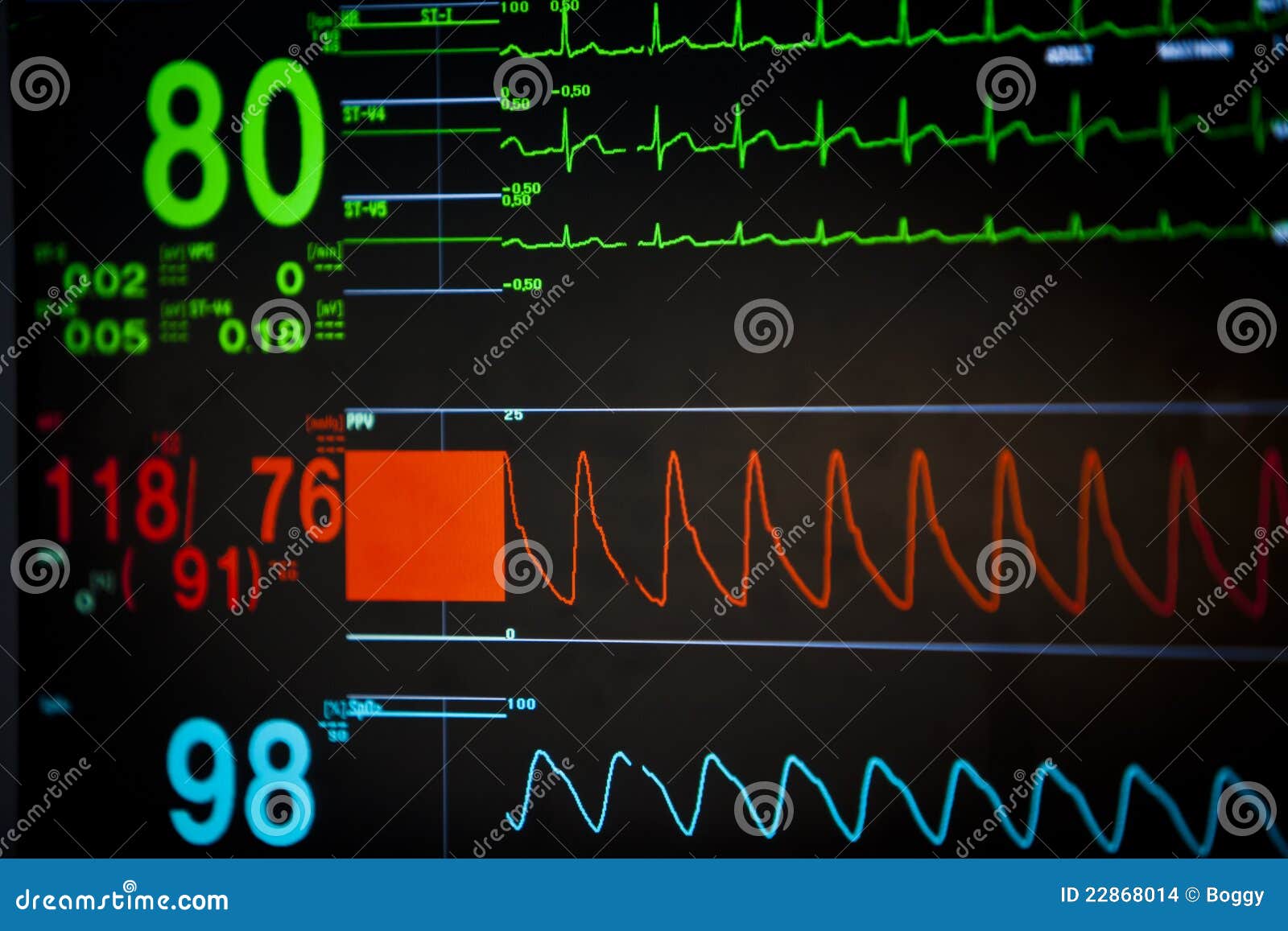 vital signs unit