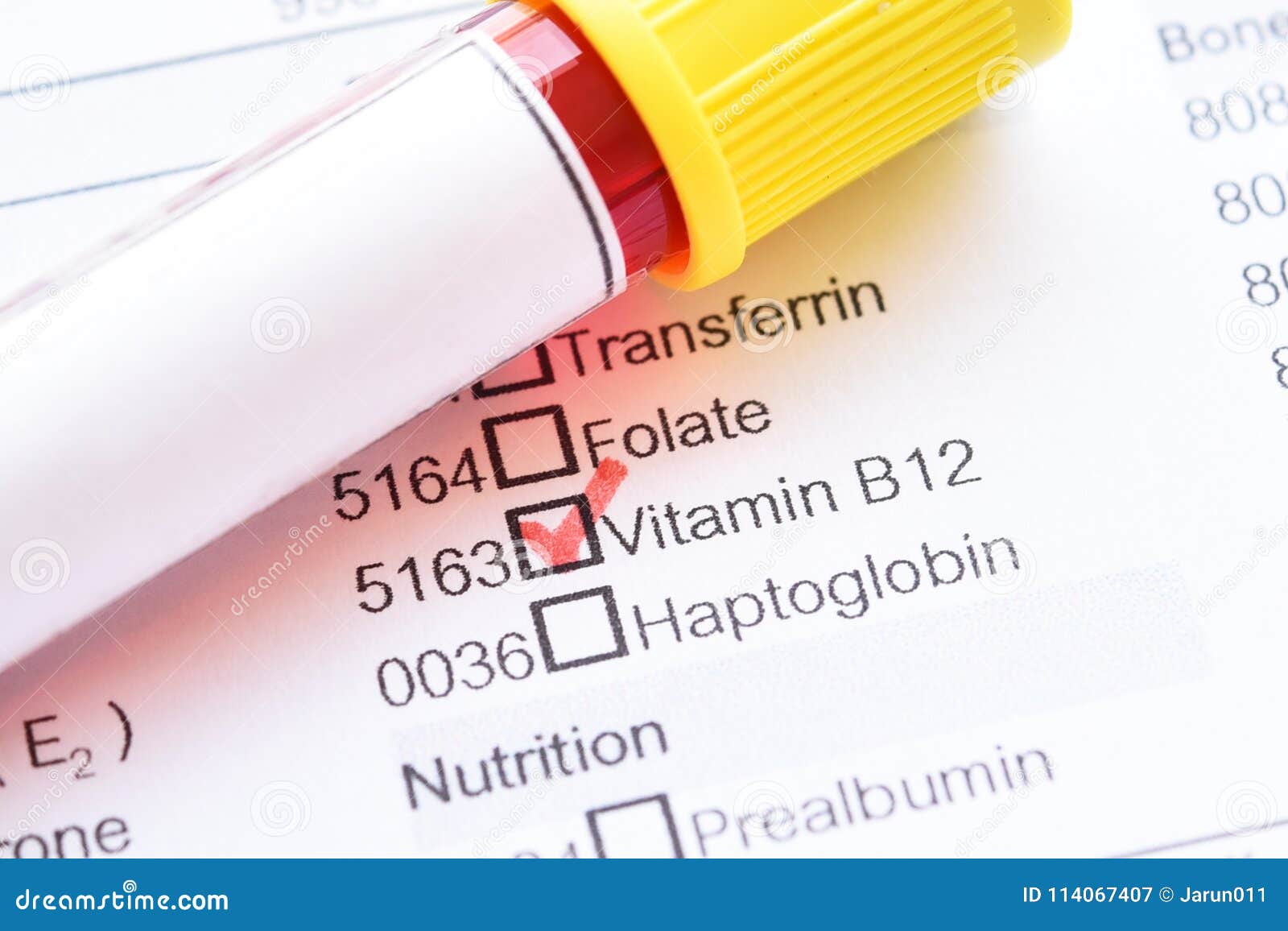 Vitamin B12 Test Stock Image Image Of Cobalamin Blood