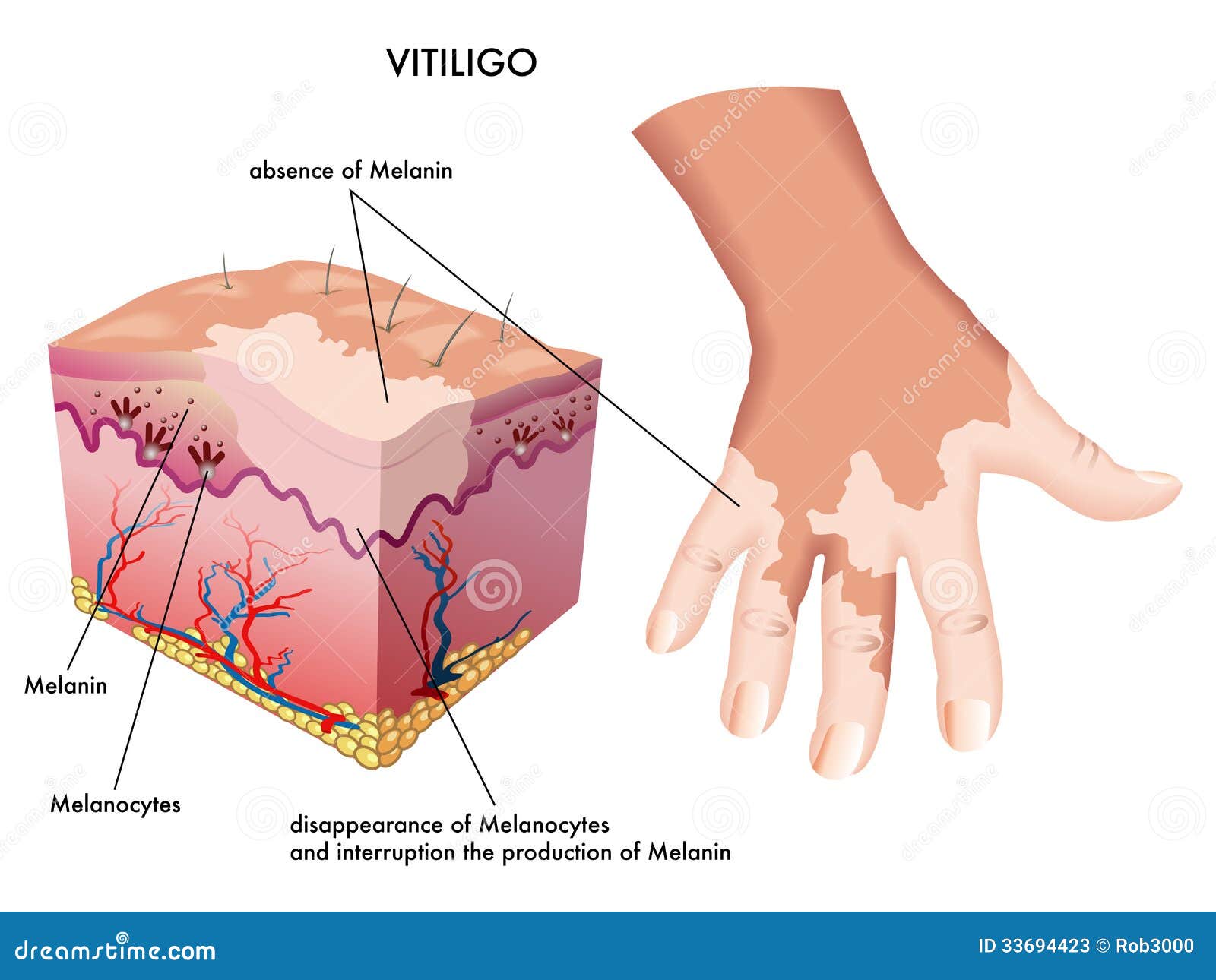 Skin Problem - bluegartr.com