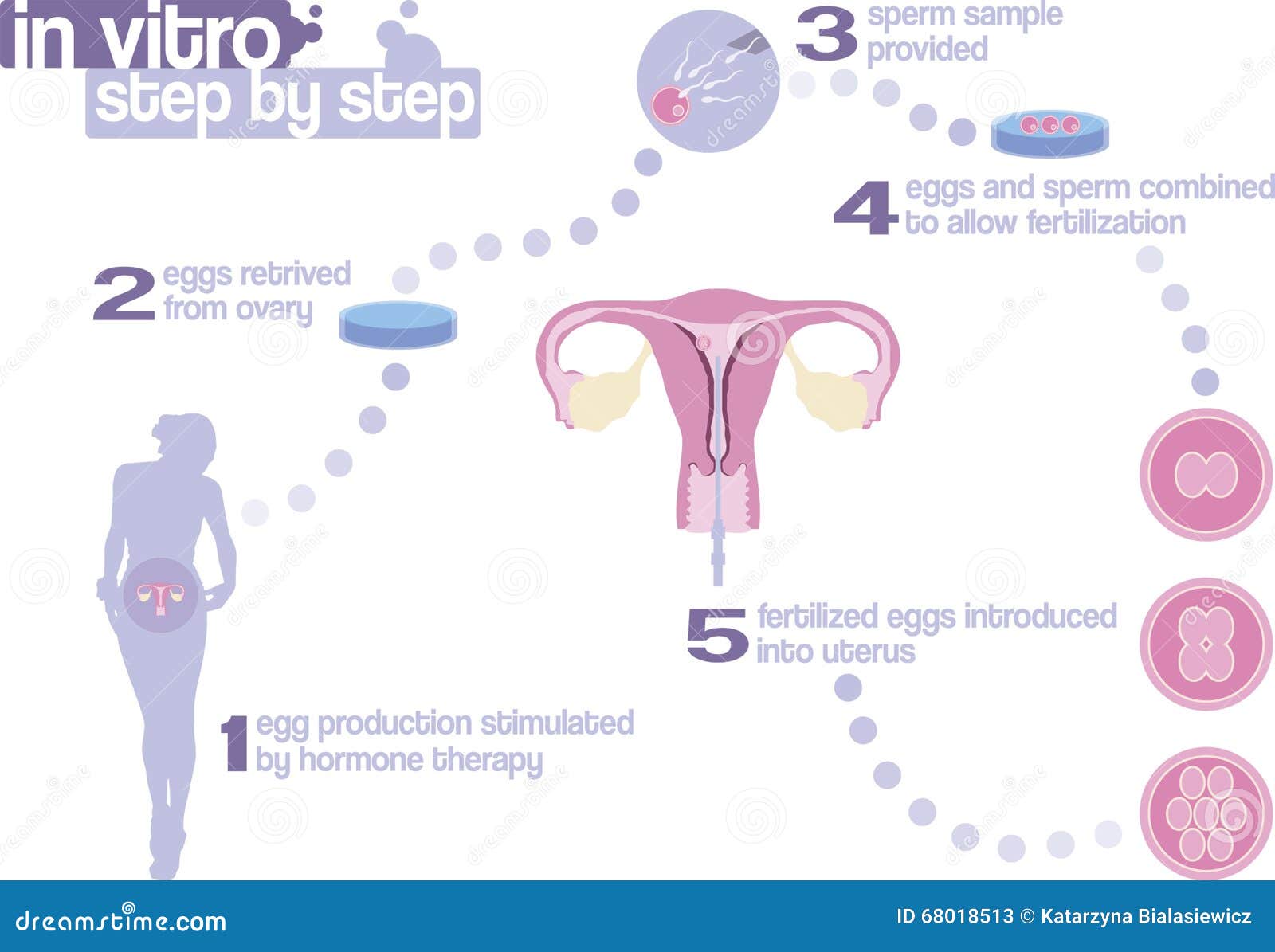 In Vitro Fertilization  Step  By Step  Stock Image Image of 