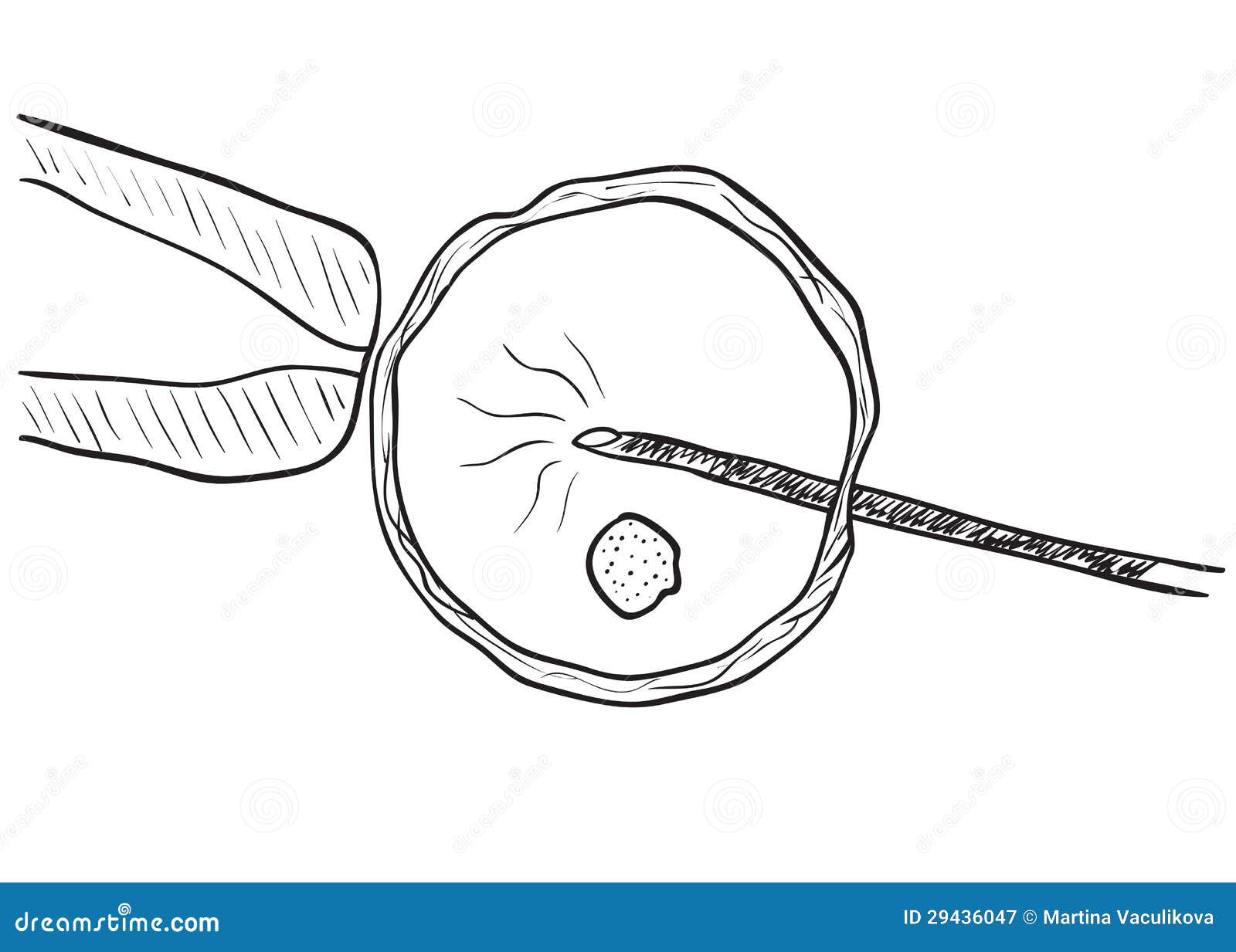 in vitro insemination drawing