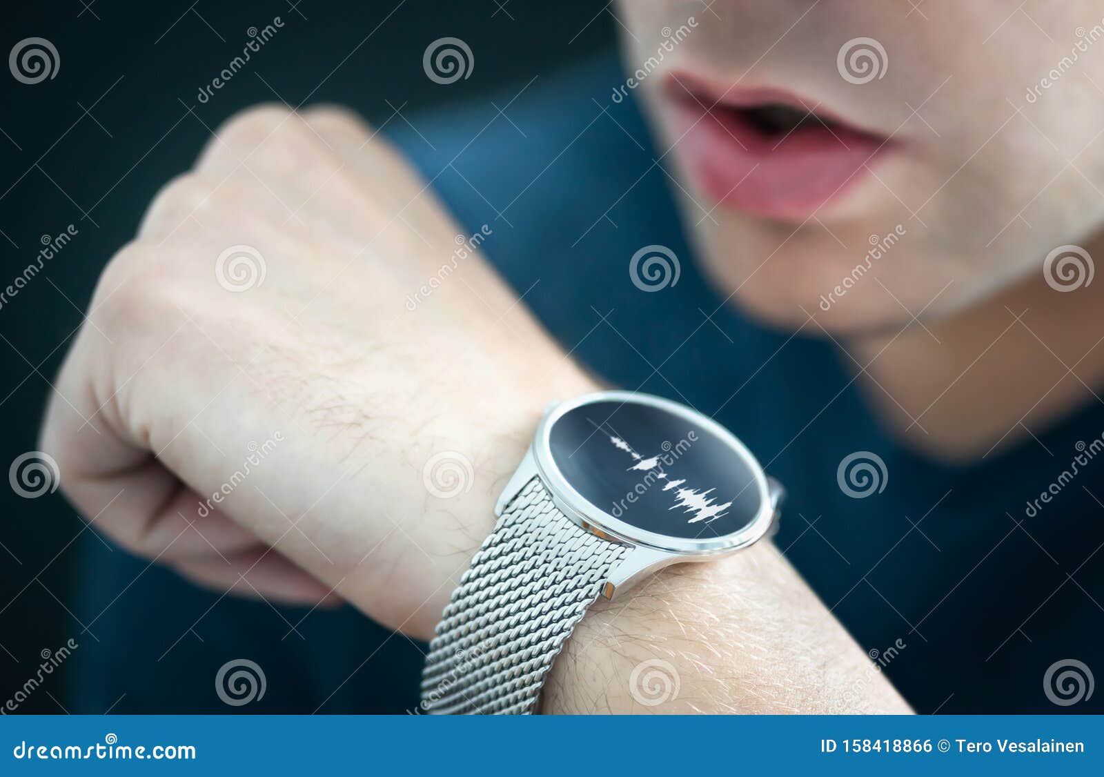 which smartwatch can you talk on